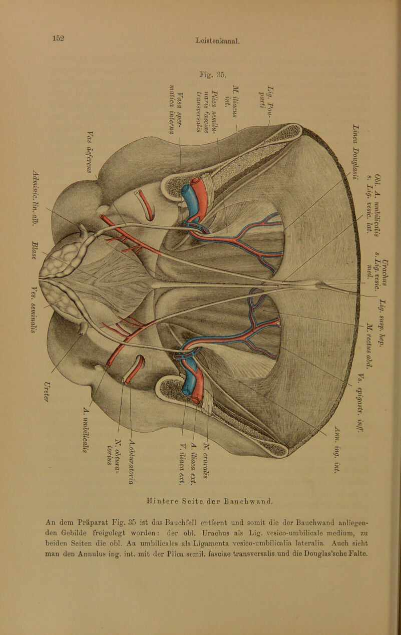 Adminic. lin. alb. Blase Ves. seminalis Fig. 35. Hintere Seite der Bauchwand. An dem Präparat Fig. 35 ist das Bauchfell entfernt und somit die der Bauchwand anliegen- den Gebilde freigelegt worden: der obl. Urachus als Lig. vesico-umbilicale medium, zu beiden Seiten die obl. Aa umbilicales als Ligamenta vesico-umbilicalia lateralia. Auch sieht man den Annulus ing. int. mit der Plica semil. fasciae transversalis und die Douglas’sche Falte.