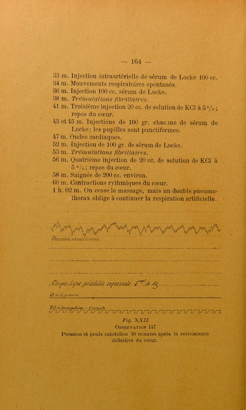 33 m. Injection intraartérielle de sérum de Locke 100 cc. 34 m. Mouvements respiratoires spontanés. 36 m. Injection 100 cc. sérum de Locke. 38 m. Trémulations fîbrillairés. 41 m. Troisième injection 20 cc. de solution de KG1 à 5 % ; repos du cœur. 43 et 45 m. Injections de 100 gr. chacune de sérum de Locke; les pupilles sont punctiformes. 47 m. Ondes cardiaques. 52 m. Injection de 100 gr. de sérum de Locke. 53 m. Trémulations fîbrillairés. 56 m. Quatrième injection de 2,0 cc. de solution de KG1 à 5 °/0 ; repos du cœur. 58 m. Saignée de 200 cc. environ. 60 m. Contractions rythmiques du cœur. 1 h. 02 m. On cesse le massage, mais un double pneumo- thorax oblige à continuer la respiration artificielle. . O/iaytic.Jcÿtie.fiùrJùfce. O .i’t Sc f.-'CzsSoa Fig. XXII Observation 147 Pression et pouls catotidien 30 minutes après la reviviscence définitive du cœur.