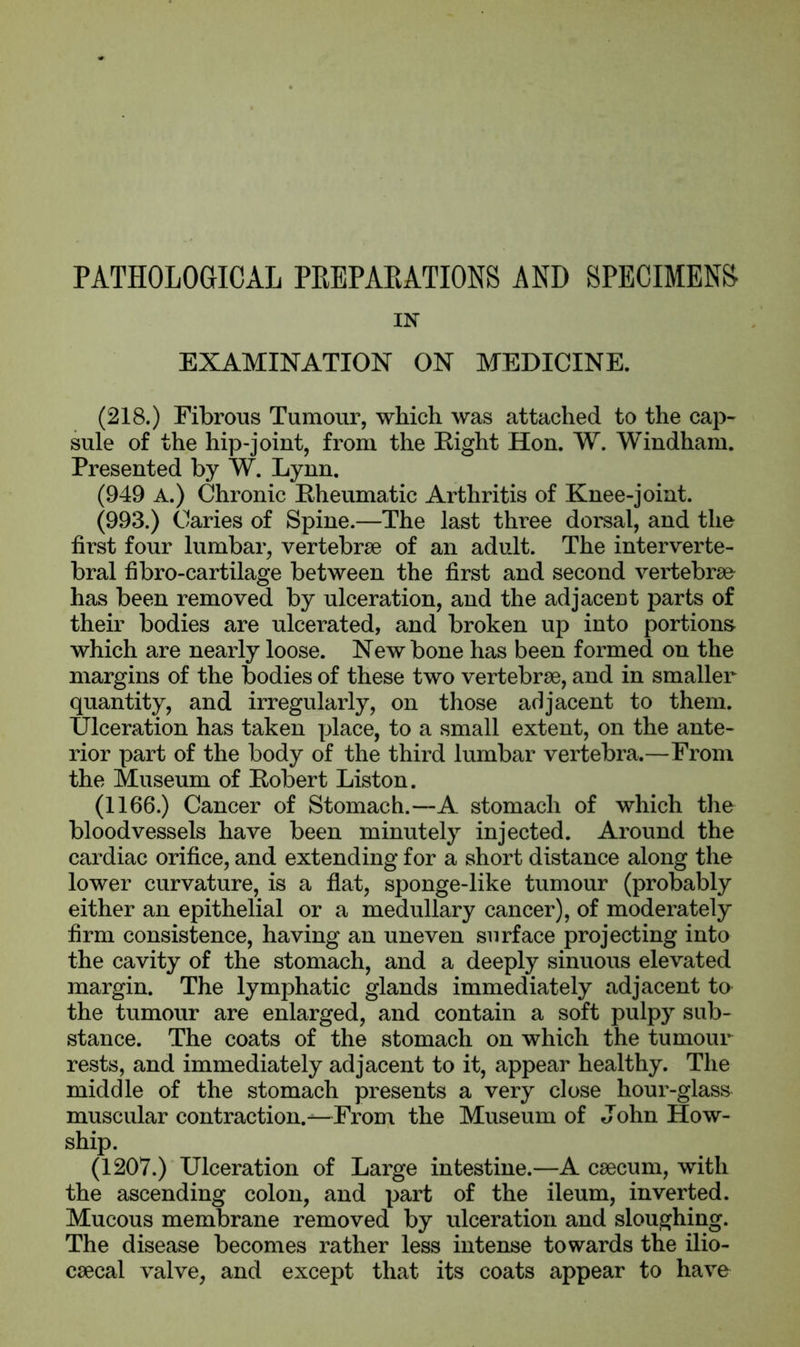 PATHOLOGICAL PREPARATIONS AND SPECIMENS IN EXAMINATION ON MEDICINE. (218.) Fibrous Tumour, which was attached to the cap- sule of the hip-joint, from the Eight Hon. W. Windham. Presented by W. Lynn. (949 A.) Chronic Eheumatic Arthritis of Knee-joint. (993.) Caries of Spine.—The last three dorsal, and the first four lumbar, vertebrae of an adult. The interverte- bral fibro-cartilage between the first and second vertebrae has been removed by ulceration, and the adjacent parts of their bodies are ulcerated, and broken up into portions which are nearly loose. New bone has been formed on the margins of the bodies of these two vertebrae, and in smaller quantity, and irregularly, on those adjacent to them. Ulceration has taken place, to a small extent, on the ante- rior part of the body of the third lumbar vertebra.—From the Museum of Eobert Liston. (1166.) Cancer of Stomach.—A stomach of which the bloodvessels have been minutely injected. Around the cardiac orifice, and extending for a short distance along the lower curvature, is a flat, sponge-like tumour (probably either an epithelial or a medullary cancer), of moderately firm consistence, having an uneven surface projecting into the cavity of the stomach, and a deeply sinuous elevated margin. The lymphatic glands immediately adjacent to the tumour are enlarged, and contain a soft pulpy sub- stance. The coats of the stomach on which the tumour rests, and immediately adjacent to it, appear healthy. The middle of the stomach presents a very close hour-glass muscular contraction.—From the Museum of John How- ship. (1207.) Ulceration of Large intestine.—A caecum, with the ascending colon, and part of the ileum, inverted. Mucous membrane removed by ulceration and sloughing. The disease becomes rather less intense towards the ilio- caecal valve, and except that its coats appear to have