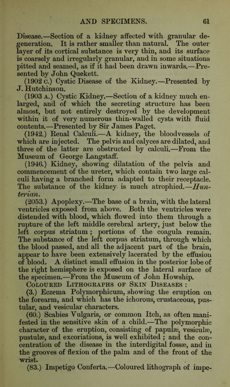 Disease.—Section of a kidney affected with granular de- generation. It is rather smaller than natural. The outer layer of its cortical substance is very thin, and its surface is coarsely and irregularly granular, and in some situations pitted and seamed, as if it had been drawn inwards.—Pre- sented by John Quekett. (1902 c.) Cystic Disease of the Kidney.—Presented by J. Hutchinson. (1903 A.) Cystic Kidney.—Section of a kidney much en- larged, and of which the secreting structure has been almost, but not entirely destroyed by the development within it of very numerous thin-walled cysts with fluid contents.—Presented by Sir James Paget. (1942.) Penal Calculi.—A kidney, the bloodvessels of which are injected. The pelvis and calyces are dilated, and three of the latter are obstructed by calculi.—From the Museum of George Langstaff. (1946.) Kidney, showing dilatation of the pelvis and commencement of the ureter, which contain two large cal- culi having a branched form adapted to their receptacle. The substance of the kidney is much atrophied.—Hun- terian. (2053.) Apoplexy.—The base of a brain, with the lateral ventricles exposed from above. Both the ventricles were distended with blood, which flowed into them through a rupture of the left middle cerebral artery, just below the left corpus striatum; portions of the coagula remain. The substance of the left corpus striatum, through which the blood passed, and all the adjacent part of the brain, appear to have been extensively lacerated by the effusion of blood. A distinct small effusion in the posterior lobe of the right hemisphere is exposed on the lateral surface of the specimen.—From the Museum of John Howship. Coloured Lithographs of Skin Diseases : (3.) Eczema Polymorphicum, showing the eruption on the forearm, and which has the ichorous, crustaceous, pus-' tular, and vesicular characters. (60.) Scabies Yulgaris, or common Itch, as often mani- fested in the sensitive skin of a child.—The polymorphic character of the eruption, consisting of papulae, vesiculae, pustulae, and excoriations, is well exhibited ; and the con- centration of the disease in the interdigital fossae, and in the grooves of flexion of the palm and of the front of the wrist. (83.) Impetigo Conferta.—Coloured lithograph of impe-