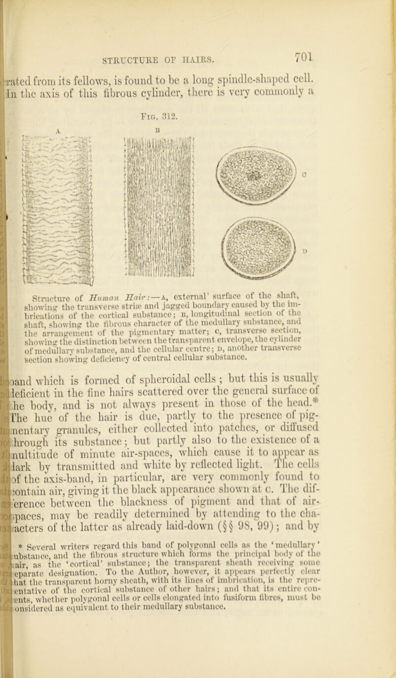 11 rated from its fellows, is found to be a long spindle-shaped cell. In the axis of this fibrous cylinder, there is very commonly a Fig. 312. A B Structure of Human Hair: — a, external surface ot the shaft, showing the transverse striae and jagged boundary caused by the im- brications of the cortical substance; b, longitudinal section ol the shaft, showing the fibrous character of the medullary substance, and the arrangement of the pigmentary matter; c, transverse section, showing the distinction between the transparent envelope, the cj Under of medullary substance, and the cellular centre; i>, another transverse section showing deficiency of central cellular substance. land which is formed of spheroidal cells ; but ibis is usually leficient in the fine hairs scattered over the general surface of :he body, and is not always present in those of the head* Che hue of the hair is due, partly to the presence of pig- nentary granules, either collected into patches, or dill used Trough its substance; but partly also to the existence of a nultitude of minute air-spaces, which cause it to appear as lark by transmitted and white by rellected light. The cells )f the axis-band, in particular, are very commonly found to contain air, giving it the black appearance shown at c. The dif- ference between the blackness of pigment and that of air- spaces, may be readily determined by attending to the cha- acters of the latter as already laid-down (§§ 98, 99); and by m * Several writers regard this band of polygonal cells as the * medullary ’ ubstance, and the fibrous structure which forms the principal body of tiio air as the ‘cortical’ substance; the transparent sheath receiving some epa’rate designation. To the Author, however, it appears perfectly clear hat the transparent horny sheath, with its lines of imbrication, is the repre- entative of the cortical substance of other hairs; and that its entire con- ents whether polygonal cells or cells elongated into fusiform libres, must be onsidered as equivalent to their medullary substance.