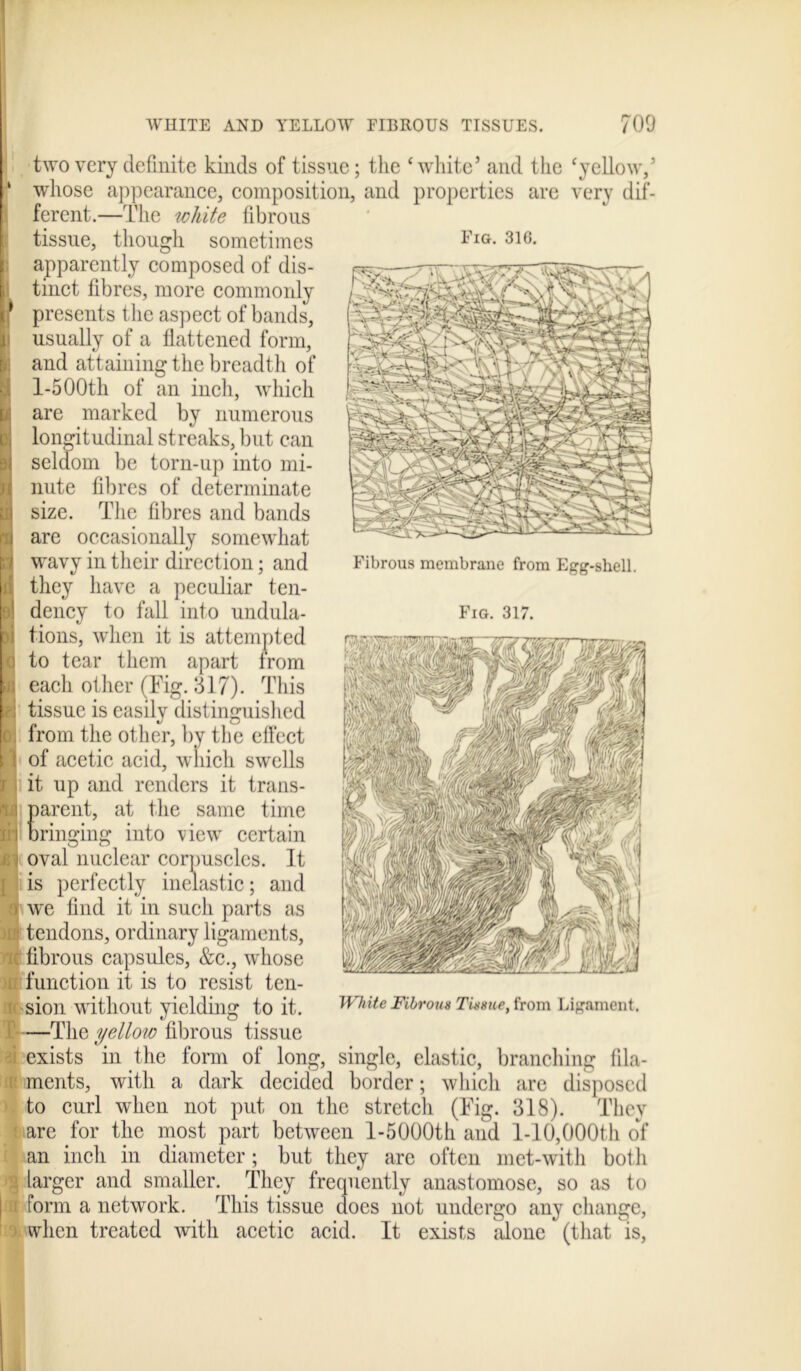 WHITE AND YELLOW FIBROUS TISSUES. 700 two very definite kinds of tissue; the ‘white’ and the ‘yellow/ whose appearance, composition, and properties are very dif- ferent.—The white fibrous Fig. 316. Fibrous membrane from Egg-shell. Fig. 317. 0: I l ■ )[[! nt iff iic T fC tissue, though sometimes apparently composed of dis- tinct fibres, more commonly presents the aspect of bands, usually of a flattened form, and attaining the breadth of 1-5 00th of an inch, which are marked by numerous longitudinal streaks, but can seldom be torn-up into mi- nute fibres of determinate size. The fibres and bands arc occasionally somewhat wavy in their direction; and they have a peculiar ten- dency to fall into undula- tions, when it is attempted to tear them apart from each other (Tig. 317). This tissue is easilv distinguished from the other, by the effect of acetic acid, which swells it up and renders it trans- parent, at the same time bringing into view certain oval nuclear corpuscles. It is perfectly inelastic; and we find it in such parts as tendons, ordinary ligaments, fibrous capsules, &c., whose function it is to resist ten- sion without yielding to it. —The yellow fibrous tissue exists in the form of long, # , ments, with a dark decided border; which are disposed to curl when not put on the stretch (Fig. 318). They are for the most part between l-5000th and 1-10,000th of an inch in diameter; but they are often met-with both larger and smaller. They frequently anastomose, so as to form a network. This tissue docs not undergo any change, when treated with acetic acid. It exists alone (that is, White Fibrous Tissue, from Ligament, single, elastic, branching fila-