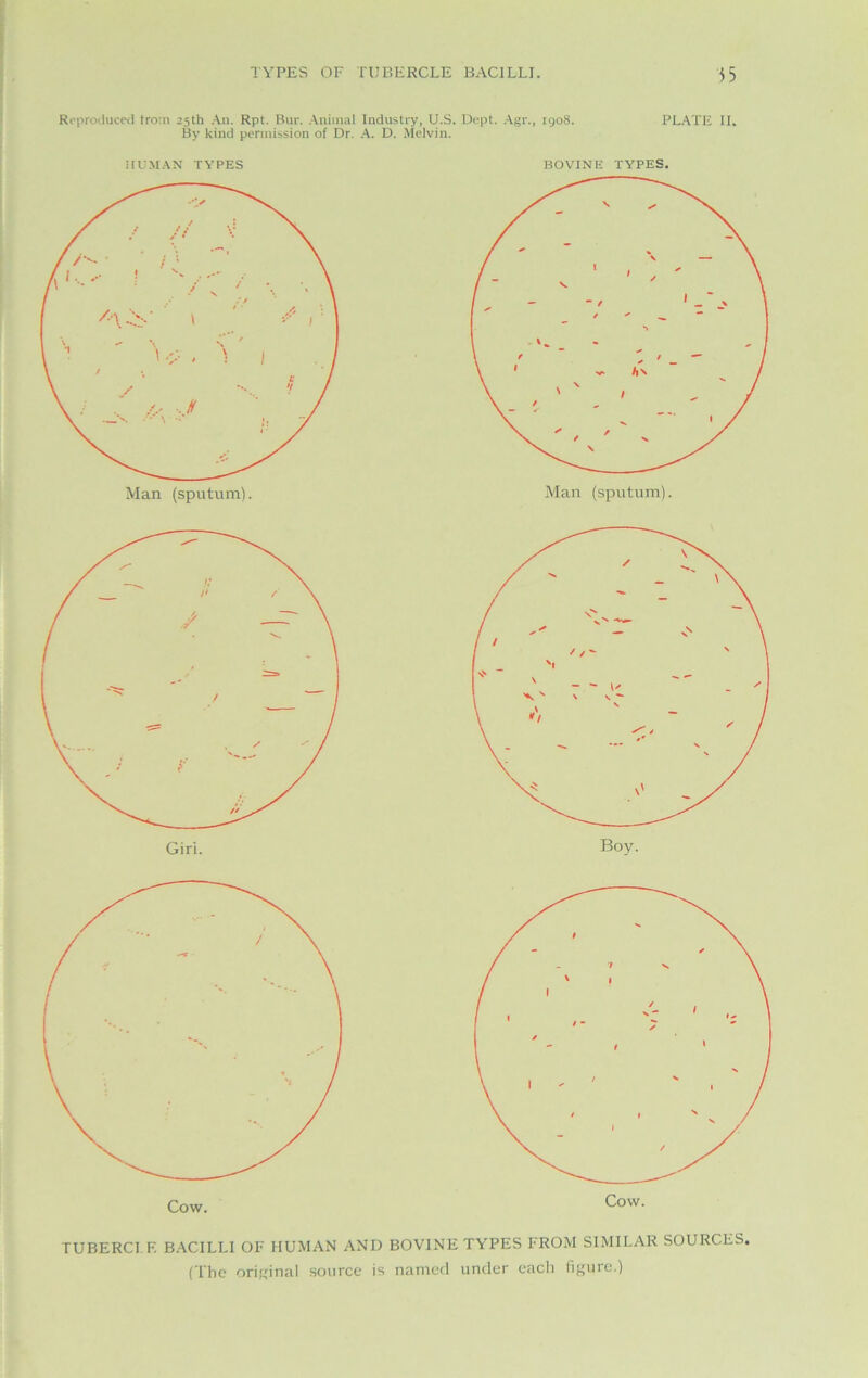 Reproduced trom cjth An. Rpt. Bur. Animal Industry, U.S. Dept. Agr., 1908. PLATE II. By kind permission of Dr. A. D. Melvin. HUMAN TYPES BOVINE TYPES. Boy. TUBERCI F. BACILLI OF HUMAN AND BOVINE TYPES FROM SIMILAR SOURCES (The original source is named under each figure.)