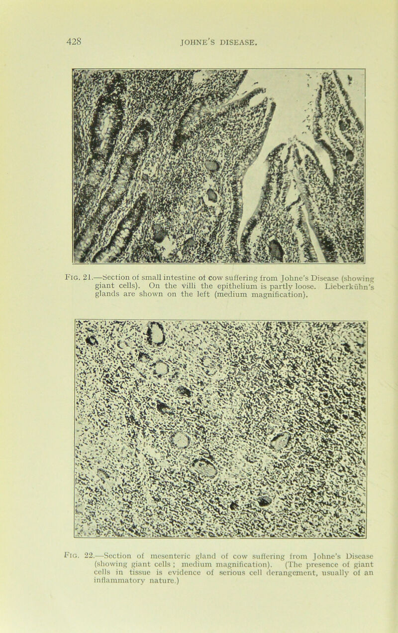 Fig. 21.—Section of small intestine of cow suffering from Johne’s Disease (showing giant cells). On the villi the epithelium is partly loose. Lieberkuhn’s glands are shown on the left (medium magnification). Fig. 22.—Section of mesenteric gland of cow sullering from Johne’s Disease (showing giant cells ; medium magnification). (The presence of giant cells in tissue is evidence of serious cell derangement, usually of an inflammatory nature.)