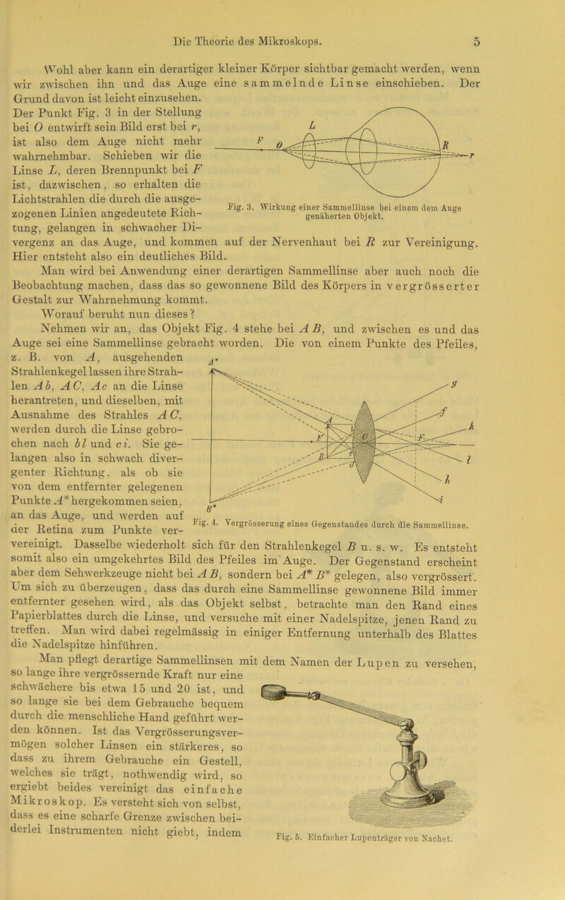 M — / ***'• \ fig. 3. Wirkung einer Sammellinse bei einem dem Auge genäherten Objekt. Wohl aber kann ein derartiger kleiner Körper sichtbar gemacht werden, wenn wir zwischen ihn und das Auge eine sammelnde Linse einschieben. Der Grund davon ist leicht einzusehen. Der Punkt Fig. 3 in der Stellung bei O entwirft sein Bild erst bei r, ist also dem Auge nicht mehr wahrnehmbar. Schieben wir die Linse L, deren Brennpunkt bei F ist, dazwischen, so erhalten, die Lichtstrahlen die durch die ausge- zogenen Linien angedeutete Rich- tung, gelangen in schwacher Di- vergenz an das Auge, und kommen auf der Nervenhaut bei R zur Vereinigung. Hier entsteht also ein deutliches Bild. Man wird bei Anwendung einer derartigen Sammellinse aber auch noch die Beobachtung machen, dass das so gewonnene Bild des Körpers in v ergrösserter Gestalt zur Wahrnehmung kommt. AVorauf beruht nun dieses ? Nehmen wir an, das Objekt Fig. 4 stehe bei AB, und zwischen es und das Auge sei eine Sammellinse gebracht worden. Die von einem Punkte des Pfeiles, z. B. von A, ausgehenden Strahlenkegel lassen ihre Strah- len Ab, AC, Ac an die Linse herantreten, und dieselben, mit Ausnahme des Strahles A C, werden durch die Linse gebro- chen nach bl und ci. Sie ge- langen also in schwach diver- genter Richtung, als ob sie von dem entfernter gelegenen Punkte ^4*hergekommen seien, an das Auge, und werden auf der Retina zum Punkte ver- vereinigt. Dasselbe wiederholt Fig. 4. Vergrösserung eines Gegenstandes durch die Sammellinse. sich für den Strahlenkegel .ß u. s. w. Es entsteht somit also ein umgekehrtes Bild des Pfeiles im Auge. Der Gegenstand erscheint aber dem Sehwerkzeuge nicht bei ^ß, sondern bei A* B* gelegen, also vergrössert. Um sich zu überzeugen, dass das durch eine Sammellinse gewonnene Bild immer entfernter gesehen wird, als das Objekt selbst, betrachte man den Rand eines Papierblattes durch die Linse, und versuche mit einer Nadelspitze, jenen Rand zu treffen. Man wird dabei regelmässig in einiger Entfernung unterhalb des Blattes die Nadelspitze hinführen. Man pflegt derartige Sammellinsen mit dem Namen der Lupen zu versehen, so lange ihre vergrössernde Kraft nur eine ’ schwächere bis etwa 15 und 20 ist, und so lange sie bei dem Gebrauche bequem durch die menschliche Hand geführt wer- den können. Ist das Vergrösserungsver- mögen solcher Linsen ein stärkeres, so dass zu ihrem Gebrauche ein Gestell, welches sie trägt, nothwendig wird, so ergiebt beides vereinigt das einfache Mikroskop. Es versteht sich von selbst, dass es eine scharfe Grenze zwischen bei- derlei Insti-umenten nicht giebt, indem . t,- c i t * • ^ ^ Tig. 5. Einfacher Lupoutrager von Nachet.