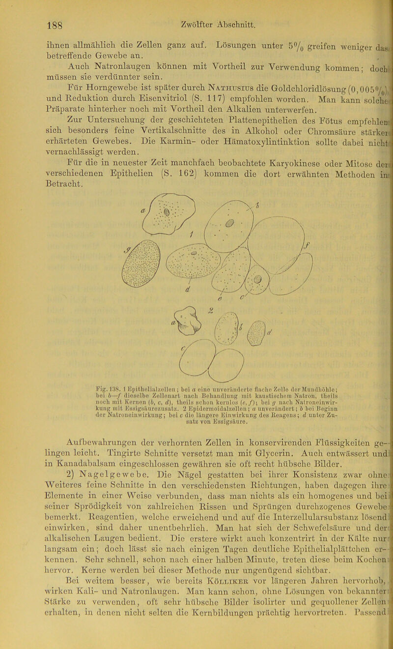 ihnen allmählich die Zellen ganz auf. Lösungen unter S^o greifen weniger da&- betreffende Gewebe an. Auch Natronlaugen können mit Vortheil zur Verwendung kommen; doch( müssen sie verdünnter sein. Für Horngewebe ist später durch Nathüsius die Goldchloridlösung (0,005 und Reduktion durch Eisenvitriol (S. 117) empfohlen worden. Man kann solcheii Präparate hinterher noch mit Vortheil den Alkalien unterwerfen. Zur Untersuchung der geschichteten Plattenepithelien des Fötus empfehlen- sich besonders feine Vertikalschnitte des in Alkohol oder Chromsäure stärkeif erhärteten Gewebes. Die Karmin- oder Hämatoxylintinktion sollte dabei nichtt vernachlässigt werden. Für die in neuester Zeit manchfach beobachtete Karyokinese oder Mitose derj verschiedenen Epithelien (S. 162) kommen die dort erwähnten Methoden inif Betracht. Fig. IltS. I Epitliüliiil'/.ollon; boi n oinb unvoriindorto fliiclio Zollo dorMumlliühlo; bei b~f (lioBolbo Zollomirl nach Boliamlluuu mit kauBtiBcboin Natron, tbeils noch mit ICornon (4, c, d), thoils Bchon kcrnluB (c,/); boi // nach Nalronoinwir- kuiiK mit lOBHigHäuro/.nBal/,. 2 JOpidormoiclal’/.olIon; « unverändort; b boi Beginn der Natrunoinwirkung; bei c die läiigoru Einwirkung des lloagouB; d unter Zu- satz von Ussigsüuro. Aufbewahrungen der verhornten Zellen in konservirenden Flüssigkeiten ge- lingen leicht. Tingirtc Schnitte versetzt man mit Glycerin. Auch entwässert und; in Kanadabalsam eingeschlossen gewähren sie oft recht hübsche Bilder. 2) Nagelgewebe. Die Nägel gestatten bei ihrer Konsistenz zwar ohne. Weiteres feine Schnitte in den verschiedensten Richtungen, haben dagegen ihre Elemente in einer Weise verbunden, dass man nichts als ein homogenes und bei seiner Sprödigkeit von zahlreichen Rissen und Sprüngen durchzogenes Gewebe! bemerkt. Reagentien, welche erweichend und auf die Interzellularsubstanz lösend einwirken, sind daher unentbehrlich. Man hat sich der Schwefelsäure und der; alkalischen Laugen bedient. Die erstere wirkt auch konzentrirt in der Kälte nur'i langsam ein; doch lässt sie nach einigen Tagen deutliche Epithelialplättchen er- kennen. Sehr schnell, schon nach einer halben Minute, treten diese beim Kochen hervor. Kerne werden bei dieser Methode nur ungenügend sichtbar. Bei weitem besser, wie bereits Köluikeb vor längeren Jahren hervorhob, wirken Kali- und Natronlaugen. Man kann schon, ohne liösungen von bekannter Stärke zu verwenden, oft sehr hübsche Bilder isolirter und gequollener Zellen erhalten, in denen nicht selten die Kcrnbildungen prächtig hervortreten. Passend