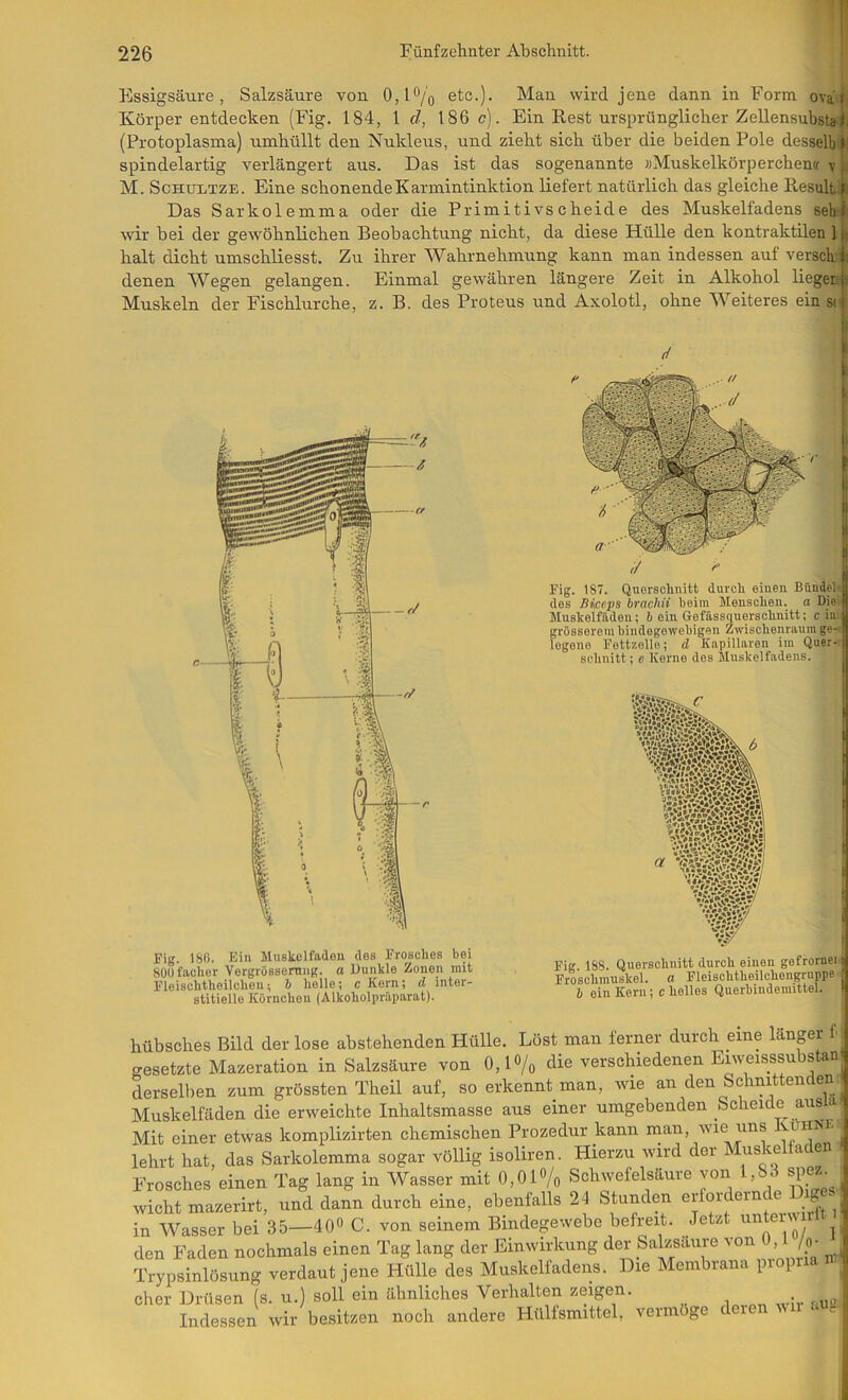 Essigsäure, Salzsäure von 0,l®/o etc.). Man wird jene dann in Form ova» Körper entdecken (Fig. 184, \ d, 186 c). Ein Rest ursprünglicher Zellensubsta Ji (Protoplasma) umhüllt den Nukleus, und zieht sich über die beiden Pole desselbjl spindelartig verlängert aus. Das ist das sogenannte »Muskelkörperchen« v M. ScHULTZE. Eine schonendeKarmintinktion liefert natürlich das gleiche Resulfc^ Das Sarkolemma oder die Primitivscheide des Muskelfadens 8eh.-| wir bei der gewöhnlichen Beobachtung nicht, da diese Hülle den kontraktilen 1 (» halt dicht umschliesst. Zu ihrer Wahrnehmung kann man indessen auf versck^ denen Wegen gelangen. Einmal gewähren längere Zeit in Alkohol lieget.j-^ Muskeln der Fischlurche, z. B. des Proteus und Axolotl, ohne Weiteres ein si i Fig. 180. Ein Muskulfadau des Frosches bei SOüfaoher Vergrössennig. o Dunkle Zonen mit Fleischtheilcheu; b helle; c Kern; d inter- stitielle Körnchen (Alkoholpräparat). Fig. 187. Querschnitt durch einen Bündeln des Biceps brachii heim Menschen, a Die ,* Muskelfäden; ö ein Gefässquerschnitt; c iuA grösserem hindogewehigen Zwischenraum ge-) legono Fettzolle; d Kapillaren im Quer- jf schnitt; e Korne des Muskelfadens. wmm Fig. 188. Querschnitt durch einen gefrornei | Froschmuskel, a Fleischtheilchengruppsi b ein Kern; c holles Querhindemittel. 1 hübsches Bild der lose abstehenden Hülle. Löst man ferner durch mne länger f gesetzte Mazeration in Salzsäure von 0,lo/o die verschiedenen Eiweisssubstan derselben zum grössten Theil auf, so erkennt man, wie an den Schnittenden Muskelfäden die erweichte Inhaltsmasse aus einer umgebenden Scheide ausia i Mit einer etwas komplizirten chemischen Prozedur kann rrian, wie uns lehrt hat, das Sarkolemma sogar völlig isoliren. Hierzu wird der Mm m a en J Frosches einen Tag lang in Wasser mit 0,01% Schwefelsänre von 1.88 s|je._ ( wicht maserirt, nnd dann durch eine, ebenfalls 24 Stunden in Wasser bei 35—40« C. von seinem Bindegewebe befreit. Jetzt i^nteiwii 1 asser bei do—von smuum , n 10/ 1 » den Faden nochmals einen Tag lang der Einwirkung der Salzsaure von 0,1 ^ J inlösung verdaut jene Hülle des Muskelfadens. Die Membrana propiia Trypsinlösung „ eher Drüsen (s. u.) soll ein ähnliches Verhalten zeigen. Indessen wir besitzen noch andere Hülfsmittel, vermöge d