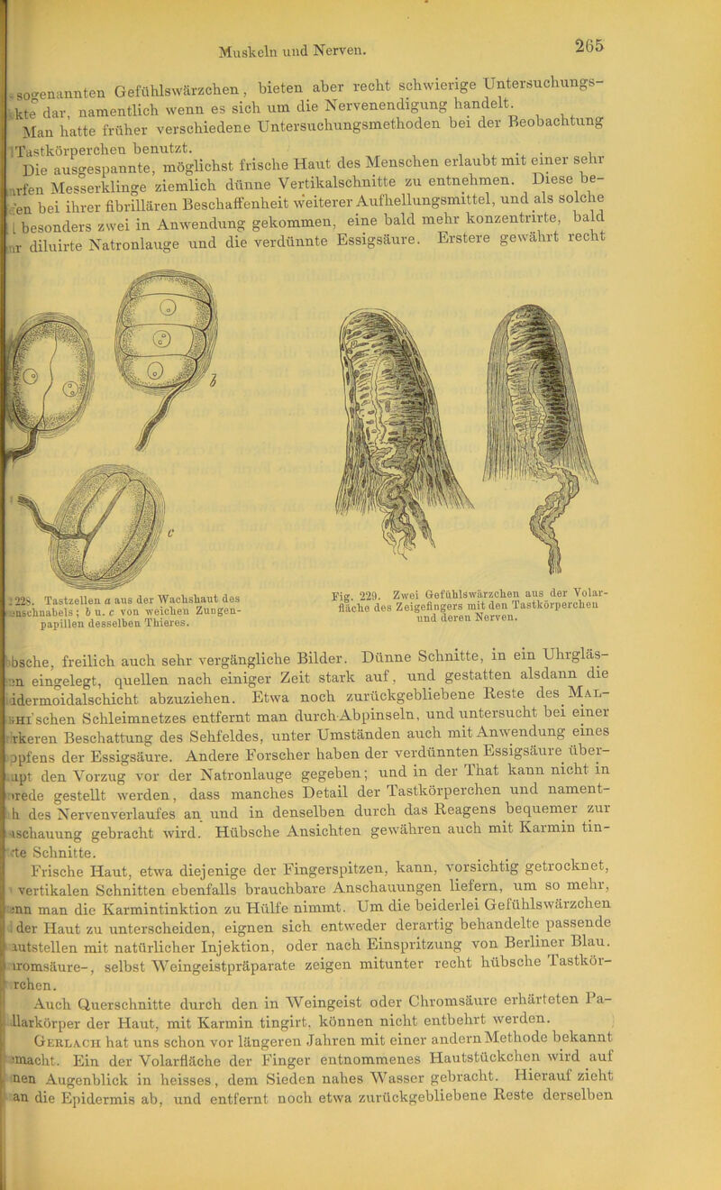 .o-enannten Gefühlswärzchen, bieten aber recht schwierige Untersnchungs- - kte dar namentlich wenn es sich um die Nervenendigung handelt^ Mau hatte früher verschiedene Untersuchungsmethoden bei der Beobachtung iTastkörperchen benutzt. , , • i Die aus-espannte, möglichst frische Haut des Menschen erlaubt mit einer sehr ,vfen Messerklinge ziemlich dünne Vertikalschnitte zu entnehmen. Diese be- <;en bei ihrer fibrillären Beschaffenheit Weiterer Aufhellungsmittel, und als solche I besonders zwei in Anwendung gekommen, eine bald mehr konzentrirte, baM nr diluirte Natronlauge und die verdünnte Essigsäure. Erstere gewahrt recht 122^5. Tastzellen a aus der Wachsliant des fEnschnabels ; 6 u. c von ■\veiclien Zungen- papillen desselben Tbieres. Fig. 229. Zwei Gefühlswärzclien aus der Volar fläclie des Zeigefingers mit den Tastkörpercbeu und deren Nerven. bbsche, freilich auch sehr vergängliche Bilder. Dünne Schnitte, in ein Uhrgläs- ■;in eingelegt, quellen nach einiger Zeit stark auf, und gestatten alsdann die iidermoidalschicht abzuziehen. Etwa noch zurückgebliebene Reste des Mal- BHi'schen Schleimnetzes entfernt man durch-Abpinseln, und untersucht bei einer r'rkeren Beschattung des Sehfeldes, unter Umständen auch mit Anwendung eines jpfens der Essigsäure. Andere Forscher haben der verdünnten Essigsäure^ übei- .apt den Vorzug vor der Natronlauge gegeben; und in der That kann nicht in irede gestellt werden, dass manches Detail der Tastkörperchen und nament- h des Nervenverlaufes an und in denselben durch das Reagens bequemer zur 'ischauung gebracht wird. Hübsche Ansichten gewähren auch mit Karmin tin- ’.rte Schnitte. Frische Hant, etwa diejenige der Fingerspitzen, kann, vorsichtig getrocknet, vertikalen Schnitten ebenfalls brauchbare Anschauungen liefern, um so mehi, inn man die Karmintinktion zu Hülfe nimmt. Um die beiderlei Gefühlswäizchen : der Haut zu unterscheiden, eignen sich entweder derartig behandelte passende ' autstellen mit natürlicher Injektion, oder nach Einspritzung von Berliner Blan. iromsäure-, selbst \Veingeistpräparate zeigen mitunter recht hübsche lastköi- rrchen. Auch Querschnitte durch den in Weingeist oder Chronisäure erhärteten 1 a- I llarkörper der Hant, mit Karmin tingirt, können nicht entbehrt werden. Gerlach hat nns schon vor längeren Jahren mit einer andern Methode bekannt ■unacht. Ein der Volarfläche der Finger entnommenes Hautstückchen wird auf j nen Augenblick in heisses, dem Sieden nahes Wasser gebracht. Hierauf zieht ‘ an die Epidermis ab, und entfernt noch etwa zurückgebliebene Reste derselben