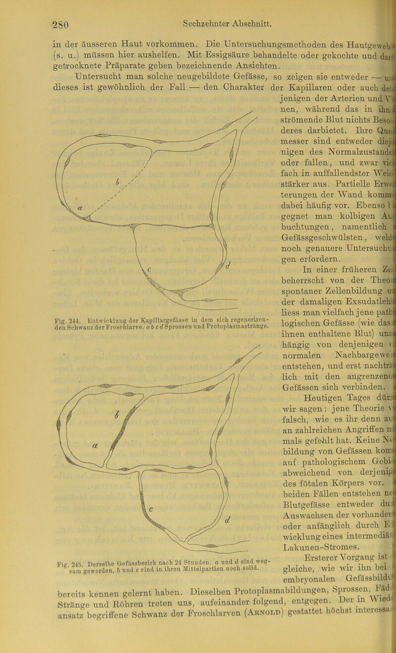 in der äusseren Haut Vorkommen. Die Untersuchungsmethoden des Hautgeweb (s. u.) müssen hier aushelfen. Mit Essigsäure behandelte oder gekochte und dar i getrocknete Präparate geben bezeichnende Ansichten. Untersucht man solche neugebildete Gefässe, so zeigen sie entweder — u, >■ dieses ist gewöhnlich der Fall — den Charakter der Kapillaren oder auch dei jenigen der Arterien und V' nen, während das in ihn strömende Blut nichts BesO' deres darbietet. Ihre Qm. messer sind entweder diejr nigen des Normalzustanddi oder fallen, und. zwar vhi) fach in auffallendster Weit stärker aus. Partielle ErwM terungen der Wand kommi^ dabei häufig vor. Ebenso l i gegnet man kolbigen An; buchtungen, namentlich Gefässgeschwülsten, welüi Fig. 241. Entwicklung der Kapillargoffisso in dem sich rogoneriron- den Schwan/, der Froschlarvo. « 6 c d Sprossen und Protoplasmastränge. noch genauere Untersuche gen erfordern. In einer früheren Ze beherrscht von der Theo j spontaner Zellenbildung nt| der damaligen Exsudatleh. liess man vielfach j ene patt logischen Gefässe (wie das ihnen enthaltene Blut) una hängig von denjenigen normalen Nachbarge we; entstehen, und erst nachträ lieh mit den angrenzenoi Gefässen sich verbinden. |( Heutigen Tages dürii wir sagen: jene Theorie tiij falsch, wie es ihr denn ar an zahlreichen Angriffen n.| mals gefehlt hat. Keine Nt bildung von Gefässen köre auf pathologischem Gebih abweichend von derjenigS des fötalen Körpers vor. ig beiden Fällen entstehen nrh Blutgefässe entweder du ‘ Auswachsen der vorhandel oder anfänglich durch E - Wicklung eines intermediäii > Lakunen-Stromes. \ Erster er Vorgang ist gleiche, wie wir ihn bei ' embryonalen Gefässbildi bereits kennen gelernt haben. Dieselben Protoplasmabildungen, Spros^n, Md>| Stränge und Rühren treten uns, aufeinanderfolgend, entgegen. Denn \Med^^ ansatz begriffene Schwanz der Froschlarven (Arnold) gestattet höchst interessa .c Fie 245 Derselbe Gefässbezirk nach 24 Stuuden. a und d sind weg sam geworden, h und c sind in ihren Mittelpartien noch solid.