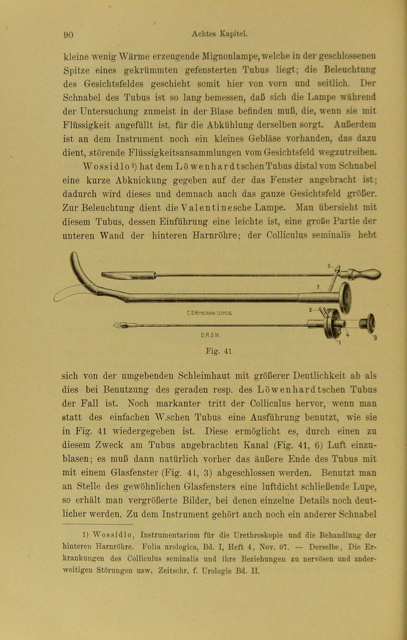 kleine tveiiig Wärme erzeugende Mignonlampe, welche in der geschlossenen Spitze eines gekrümmten gefensterten Tubus liegt; die Beleuchtung des Gesichtsfeldes geschieht somit hier von vorn und seitlich. Der Schnabel des Tubus ist so lang bemessen, daß sich die Lampe während der Untersuchung zumeist in der Blase befinden muß, die, wenn sie mit Flüssigkeit angefüllt ist, für die Abkühlung derselben sorgt. Außerdem ist an dem Instrument noch ein kleines Gebläse vorhanden, das dazu dient, störende Flüssigkeitsansammlungen vom Gesichtsfeld wegzutreiben. W 0 SS i d 101) hat dem Löwen hardt sehen Tubus distal vom Schnabel eine kurze Abknickung gegeben auf der das Fenster angebracht ist; dadurch wird dieses und demnach auch das ganze Gesichtsfeld größer. Zur Beleuchtung dient die Valentinesche Lampe. Man übersieht mit diesem Tubus, dessen Einführung eine leichte ist, eine große Partie der unteren Wand der hinteren Harnröhre; der Colliculus seminalis hebt sich von der umgebenden Schleimhaut mit größerer Deutlichkeit ab als dies bei Benutzung des geraden resp. des Löwenhardtschen Tubus der Fall ist. Noch markanter tritt der Colliculus hervor, wenn man statt des einfachen W.schen Tubus eine Ausführung benutzt, wie sie in Fig. 41 wiedergegeben ist. Diese ermöglicht es, durch einen zu diesem Zweck am Tubus angebrachten Kanal (Fig. 41, 6) Luft einzu- blasen; es muß dann natürlich vorher das äußere Ende des Tubus mit mit einem Glasfenster (Fig. 41, 3) abgeschlossen werden. Benutzt man an Stelle des gewöhnlichen Glasfensters eine luftdicht schließende Lupe, so erhält man vergrößerte Bilder, bei denen einzelne Details noch deut- licher werden. Zu dem Instrument gehört auch noch ein anderer Schnabel 1) Wossidlo, Instrumentarium für die Urethroskopie und die Behandlung- der hinteren Harnröhre. Folia urologica, Bd. I, Heft 4, Nov. 07. — Derselbe, Die Er- krankungen des Colliculus seminalis und ihre Beziehungen zu nervösen und ander- weitigen Störungen usw, Zeitschr. f. Urologie Bd. II.