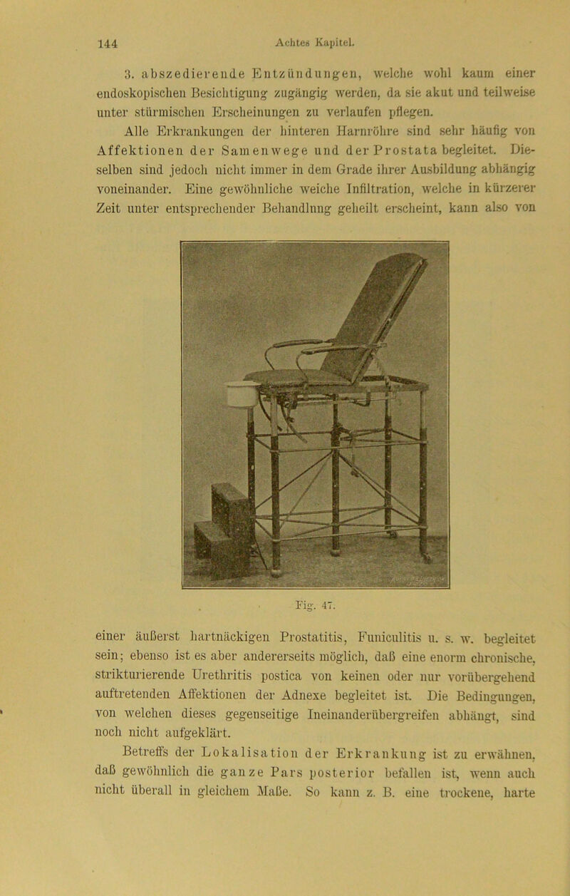 3. abszediereiide Entzündungen, welche wohl kaum einer endoskopischen Besichtigung zugängig werden, da sie akut und teilweise unter stürmischen Erscheinungen zu verlaufen pflegen. Alle Erkrankungen der hinteren Harnröhre sind sehr häufig von Affektionen der Samenwege und der Prostata begleitet. Die- selben sind jedoch nicht immer in dem Grade ihrer Ausbildung abhängig voneinander. Eine gewöhnliche iveiche Infiltration, welche in kürzerer Zeit unter entsprechender Behandlung geheilt erscheint, kann also von Fis’. 47. einer äußerst hartnäckigen Prostatitis, Funiculitis u. s. w. begleitet sein; ebenso ist es aber andererseits möglich, daß eine enorm chronische, strikturierende Urethritis postica von keinen oder nur vorübergehend auftretenden Aifektionen der Adnexe begleitet ist. Die Bedingungen, von welchen dieses gegenseitige Ineinanderübergreifen abhängt, sind noch nicht aufgeklärt. Betreffs der Lokalisation der Erkrankung ist zu erwähnen, daß gewöhnlich die ganze Pars posterior befallen ist, wenn auch nicht überall in gleichem Maße. So kann z. B. eine trockene, harte