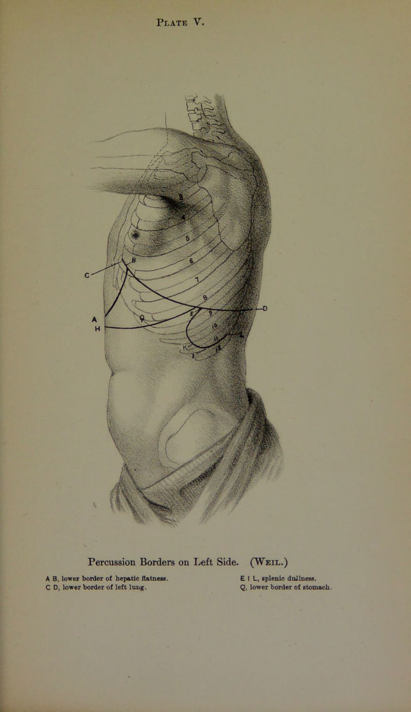 Percussion Borders on Left Side. (Weil.) A B, lower border of hepatic flatness C D, lower border of left lung. E I L, splenic dullness. Q, lower border of stomach