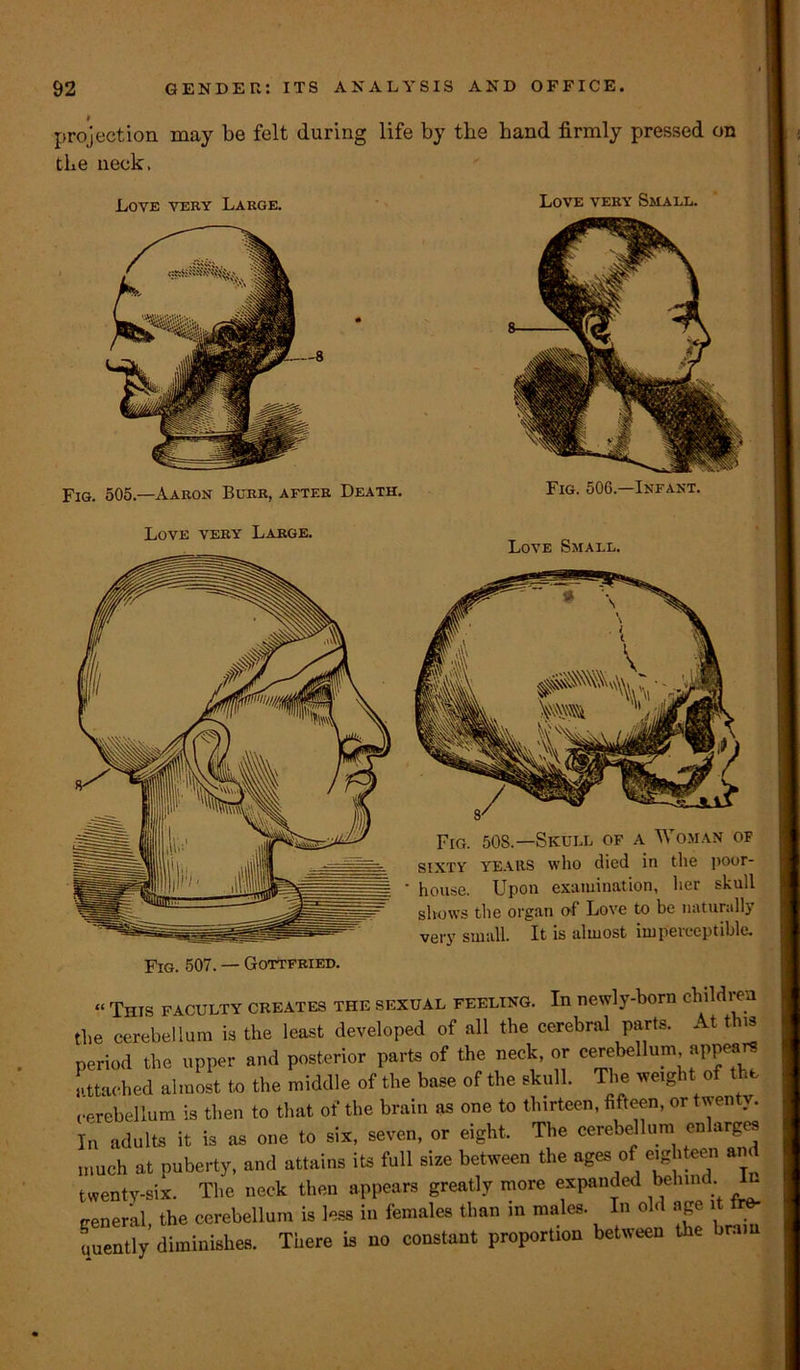 projection may be felt during life by the hand firmly pressed on the neck, Love very Large. Fig. 505.—Aaron Burr, after Death. Love very Small. Fig. 506.—Infant, Love very Large. Love Small. Fig. 508.—Skull of a Woman of sixty years who died in the poor- house. Upon examination, her skull shows the organ of Love to be naturally very small. It is almost impeiecptible. “ This faculty creates the sexual feeling. In newly-born children the cerebellum is the least developed of all the cerebral parts. At this period the upper and posterior parts of the neck, or cerebellum appears attached almost to the middle of the base of the skull. The weight of the cerebellum is then to that of the brain as one to thirteen, fifteen, or twen }. In adults it is as one to six, seven, or eight. The cerebellum enlarges much at puberty, and attains its full size between the ages of eighteen am twenty-six. The neck then appears greatly more expanded behind, general the cerebellum is less in females than in males. In old age it tra- il uently diminishes. There is no constant proportion between the brai