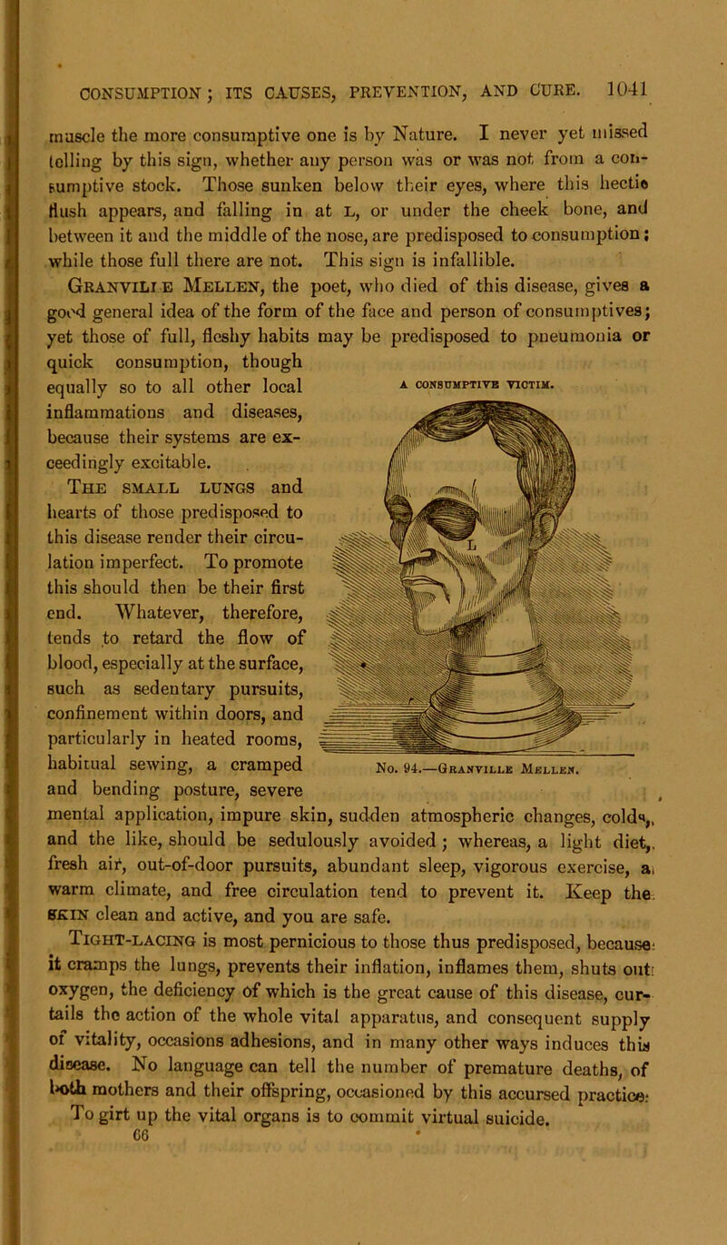 A CONSUMPTIVE VICTIM. muscle the more consumptive one is by Nature. I never yet missed telling by this sign, whether any person was or was not from a con- sumptive stock. Those sunken below their eyes, where this hectio Hush appears, and falling in at L, or under the cheek bone, and between it and the middle of the nose, are predisposed to consumption; while those full there are not. This sign is infallible. Granville Mellen, the poet, who died of this disease, gives a good general idea of the form of the face and person of consumptives; yet those of full, fleshy habits may be predisposed to pneumonia or quick consumption, though equally so to all other local inflammations and diseases, because their systems are ex- ceedingly excitable. The small lungs and hearts of those predisposed to this disease render their circu- lation imperfect. To promote this should then be their first end. Whatever, therefore, tends to retard the flow of blood, especially at the surface, such as sedentary pursuits, confinement within doors, and particularly in heated rooms, habitual sewing, a cramped and bending posture, severe No. 94.—Granville Mellen. mental application, impure skin, sudden atmospheric changes, colds,, and the like, should be sedulously avoided ; whereas, a light diet,, fresh air, out-of-door pursuits, abundant sleep, vigorous exercise, ai warm climate, and free circulation tend to prevent it. Keep the skin clean and active, and you are safe. Tight-lacing is most pernicious to those thus predisposed, because* it cramps the lungs, prevents their inflation, inflames them, shuts out: oxygen, the deficiency of which is the great cause of this disease, cur- tails the action of the whole vital apparatus, and consequent supply of vitality, occasions adhesions, and in many other ways induces this dioease. No language can tell the number of premature deaths, of ln>ih mothers and their offspring, occasioned by this accursed practice.- To girt up the vital organs is to commit virtual suicide. G6