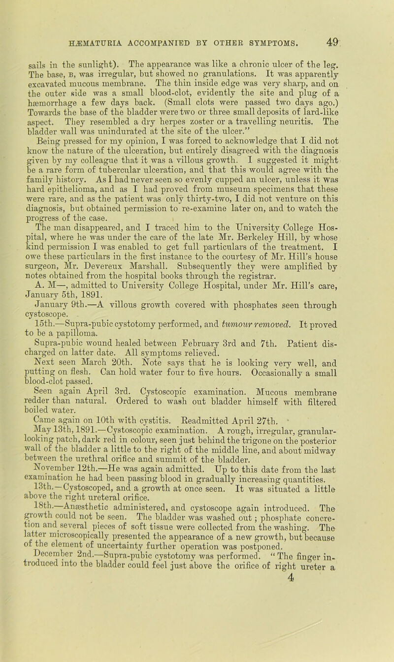 sails in the sunlisfht). The appearance was like a chronic ulcer of the leg. The base, b, was irregular, but showed no granulations. It was apparently excavated mucous membrane. The thin inside edge was very shai-p, and on the outer side was a small blood-clot, evidently the site and plug of a hffimorrhage a few days back. (Small clots were passed two days ago.) Towards the base of the bladder were two or three small deposits of lard-like aspect. They resembled a dry herpes zoster or a travelling neuritis. The bladder wall was unindurated at the site of the ulcer.” Being pressed for my opinion, I was forced to acknowledge that I did not know the nature of the ulceration, but entirely disagreed with the diagnosis given by my colleague that it was a villous growth. I suggested it might be a rare form of tubercular ulceration, and that this would agree with the family history. As I had never seen so evenly cupped an ulcer, unless it was hard epithelioma, and as I had proved from museum specimens that these were rare, and as the patient was only thirty-two, I did not venture on this diagnosis, but obtained permission to re-examine later on, and to watch the progress of the case. The man disappeared, and I traced him to the University College Hos- pital, where he was under the care of the late Mr. Berkeley Hill, by whose kind permission I was enabled to get full paificulars of the treatment. I owe these particulars in the first instance to the courtesy of Mr. Hill’s house surgeon, Mr. Devereux Marshall. Subsequently they were amplified by notes obtained from the hospital books through the registrar. A. M—, admitted to University College Hospital, under Mr. Hill’s care, January 5th, 1891. January 9th.—A villous growth covered with phosphates seen through cystoscope. loth.—Supra-pubic cystotomy performed, and tumour removed. It proved to be a papilloma. Supra-pubic wound healed between February 3rd and 7th. Patient dis- charged on latter date. All symptoms relieved. Next seen March 20th. Note says that he is looking very well, and putting on flesh. Can hold water four to five hours. Occasionally a small blood-clot passed. Seen again April 3rd. Cystoscopic examination. Mucous membrane redder than natural. Ordered to wash out bladder himself with filtered boiled water. Came again on 10th with cystitis. Eeadmitted April 27th. May 13th, 1891.—Cystoscopic examination. A rough, irregular, granular- looking patch, dark red in colour, seen just behind the trigone on the posterior wall of the bladder a little to the right of the middle line, and about midway between the urethral orifice and summit of the bladder. November 12th.—He was again admitted. Up to this date from the last examination he had been passing blood in gradually increasing quantities. 13th. —Cystoscoped, and a growth at once seen. It was situated a little above the right ureteral orifice. •^I’^ssthetic administered, and cystoscope again introduced. The ^owth could not be seen. The bladder was washed out; phosphate concre- tion and several^ pieces of soft tissue were collected from the washing. The Ifitter microscopically presented the appearance of a new growth, but because of the element of uncertainty further opei'ation was postponed. December 2nd.—Supra-pubic cystotomy was performed. “ The finger in- troduced into the bladder could feel just above the orifice of right ureter a 4