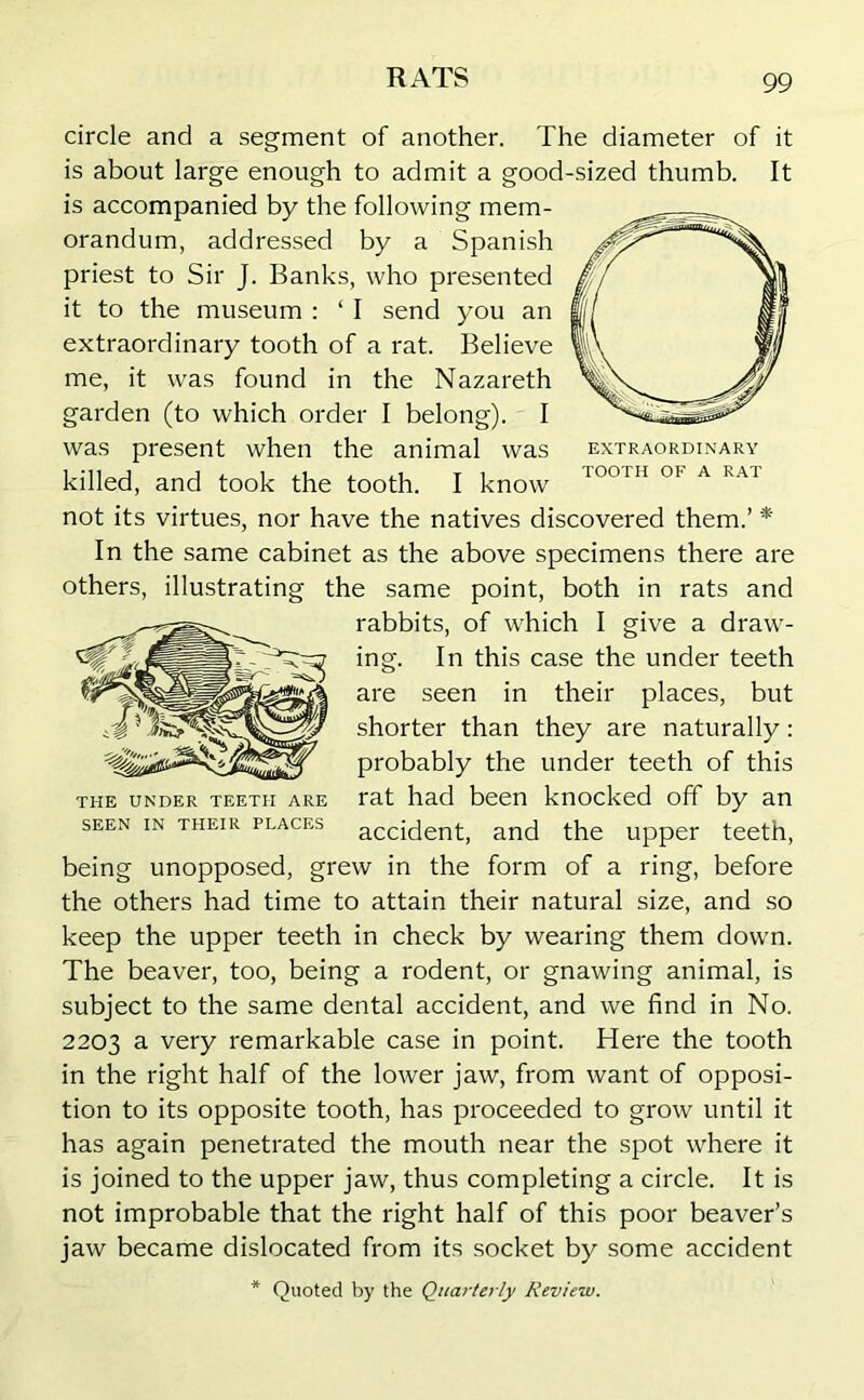 EXTRAORDINARY TOOTH OF A RAT circle and a segment of another. The diameter of it is about large enough to admit a good-sized thumb. It is accompanied by the following mem- orandum, addressed by a Spanish priest to Sir J. Banks, who presented it to the museum : ‘ I send you an extraordinary tooth of a rat. Believe me, it was found in the Nazareth garden (to which order I belong). I was present when the animal was killed, and took the tooth. I know not its virtues, nor have the natives discovered them.’ * In the same cabinet as the above specimens there are others, illustrating the same point, both in rats and rabbits, of which I give a draw- ing. In this case the under teeth are seen in their places, but shorter than they are naturally: probably the under teeth of this rat had been knocked off by an accident, and the upper teeth, being unopposed, grew in the form of a ring, before the others had time to attain their natural size, and so keep the upper teeth in check by wearing them down. The beaver, too, being a rodent, or gnawing animal, is subject to the same dental accident, and we find in No. 2203 a very remarkable case in point. Here the tooth in the right half of the lower jaw, from want of opposi- tion to its opposite tooth, has proceeded to grow until it has again penetrated the mouth near the spot where it is joined to the upper jaw, thus completing a circle. It is not improbable that the right half of this poor beaver’s jaw became dislocated from its socket by some accident * Quoted by the Quarterly Review. THE UNDER TEETH ARE SEEN IN THEIR PLACES