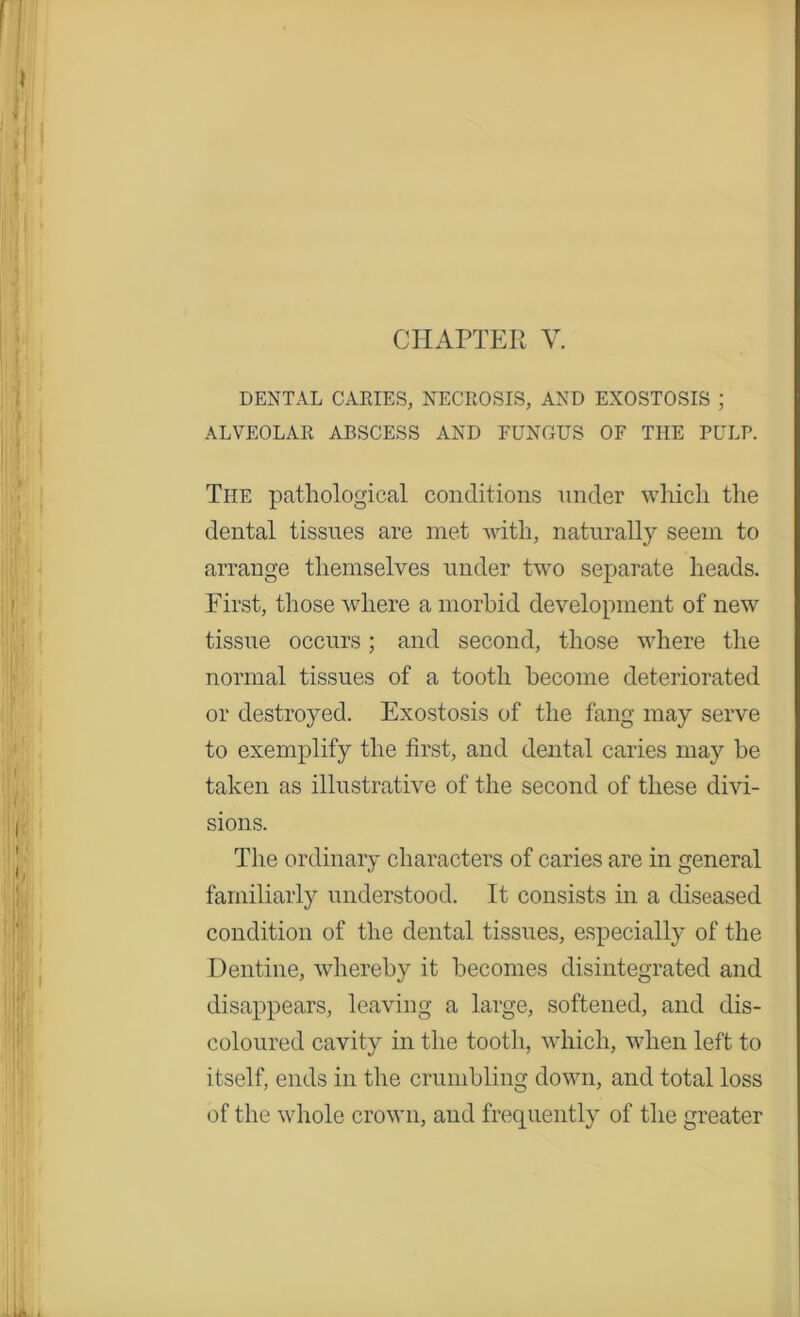 DENTAL CARIES, NECROSIS, AND EXOSTOSIS ; ALVEOLAR ABSCESS AND FUNGUS OF THE PULP. The pathological conditions under which the dental tissues are met with, naturally seem to arrange themselves under two separate heads. First, those where a morbid development of new tissue occurs; and second, those where the normal tissues of a tooth become deteriorated or destroyed. Exostosis of the fang may serve to exemplify the first, and dental caries may be taken as illustrative of the second of these divi- sions. The ordinary characters of caries are in general familiarly understood. It consists in a diseased condition of the dental tissues, especially of the Dentine, whereby it becomes disintegrated and disappears, leaving a large, softened, and dis- coloured cavity in the tooth, which, when left to itself, ends in the crumbling down, and total loss of the whole crown, and frequently of the greater