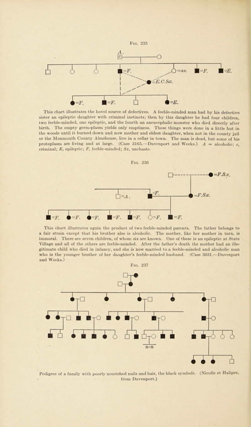 Fig. 235 A. 0 o i i 6 i=F. 2 ) —SX. £3T1 1 I w w '^r=E.c.Sx. This chart illustrates the hovel source of defectives. A feeble-minded man had by his defective sister an epileptic daughter with criminal instincts; then by this daughter he had four children, two feeble-minded, one epileptic, and the fourth an anencephalic monster who died directly after birth. The empty germ-plasm yields only emptiness. These things were done in a little hut in the woods until it burned down and now mother and eldest daughter, when not in the county jail or the Monmouth County Almshouse, live in a cellar in town. The man is dead, but some of his protoplasm are living and at large. (Case 3165.—Davenport and Weeks.) A = alcoholic; c, criminal; E, epileptic; F, feeble-minded; Sx, unchaste. Fig. 236 =F.Sx. This chart illustrates again the product of two feeble-minded parents. The father belongs to a fair strain except that his brother also is alcoholic. The mother, like her mother in turn, is immoral. There are seven children, of whom six are known. One of these is an epileptic at State Village and all of the others are feeble-minded. After the father’s death the mother had an ille- gitimate child who died in infancy, and she is now married to a feeble-minded and alcoholic man who is the younger brother of her daughter’s feeble-minded husband. (Case 3031.—Davenport and Weeks.) Fig. 237 Pedigree of a family with poorly nourished nails and hair, the black symbols. (Nicolle et Halipre, from Davenport.)