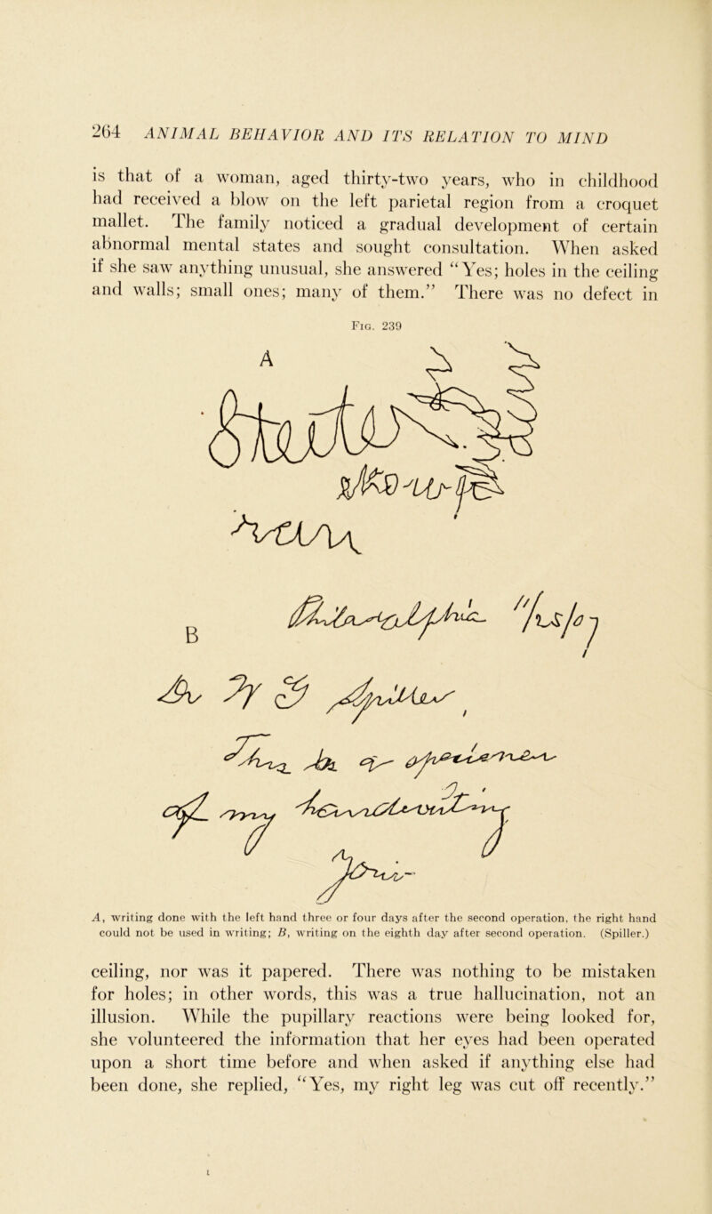 is that of a woman, aged thirty-two years, who in childhood had received a blow on the left parietal region from a croquet mallet. The family noticed a gradual development of certain abnormal mental states and sought consultation. When asked if she saw anything unusual, she answered “Yes; holes in the ceiling and walls; small ones; many of them.” There was no defect in Fig. 239 B A, writing done with the left hand three or four days after the second operation, the right hand could not be used in writing; B, writing on the eighth day after second operation. (Spiller.) ceiling, nor was it papered. There was nothing to be mistaken for holes; in other words, this was a true hallucination, not an illusion. While the pupillary reactions were being looked for, she volunteered the information that her eyes had been operated upon a short time before and when asked if anything else had been done, she replied, “Yes, my right leg was cut off recently.”