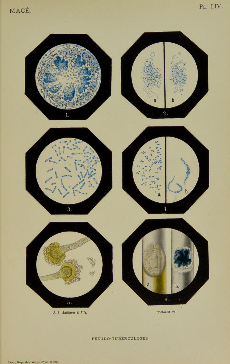 J.-B. Baillière <! Fila. Doctoroff del. PSEUDO-TUBERCULOSES ffaocj , Berger-Lrwaoll et C te. ri wnj>.