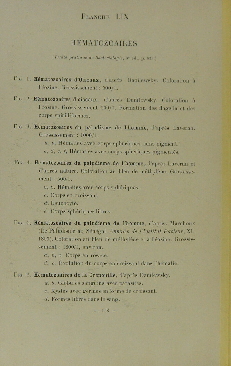 l’i.ANCHH I .I \ IIÉMATOZOAIKES (Traité pratique tic Bnctérioloç/ie, 3° i'<lp. h.'üi.) l'io. 1. Hématozoaires d'Oiseaux, d’après I)anilc\vsky. Coloration à l'éosine. Grossissement: 500/1. l'io. ‘2. Hématozoaires d'oiseaux, d’après Danilewsky. Coloration à l’éosine. Grossissement 500/1. Formation des flagella et des corps spirilliformes. Fig. 3. Hématozoaires du paludisme de l’homme, d’après Laverai). Grossissement : 1000/1. b. Hématies avec corps sphériques, sans pigment. ct d, e, /■, Hématies avec corps sphériques pigmentés. h ig. 4. Hématozoaires du paludisme de l'homme, d’après Laveran et d’après nature. Coloration au bleu de méthylène. Grossisse- ment : 500/1. a, b. Hématies avec corps sphériques. c. Corps en croissant. d. Leucocyte. e Corps sphériques libres. Fig. 5. Hématozoaires du paludisme de l’homme, d’après Marchoux (Le Paludisme au Sénégal, Annales de l'Institut Pasteur, XL 1897). Coloration au bleu de méthylène cl à l'éosine. Grossis- sement : 1200/1, environ. a, 6, c. Corps en rosace. d, e. Evolution du corps en croissant dans l'hématie. Fig. 0. Hématozoaires de la Grenouille, d’après Danilewsky. a, b. Globules sanguins avec parasites. c. Kystes avec germes en forme de croissant. d. Formes libres dans le sang. i is —