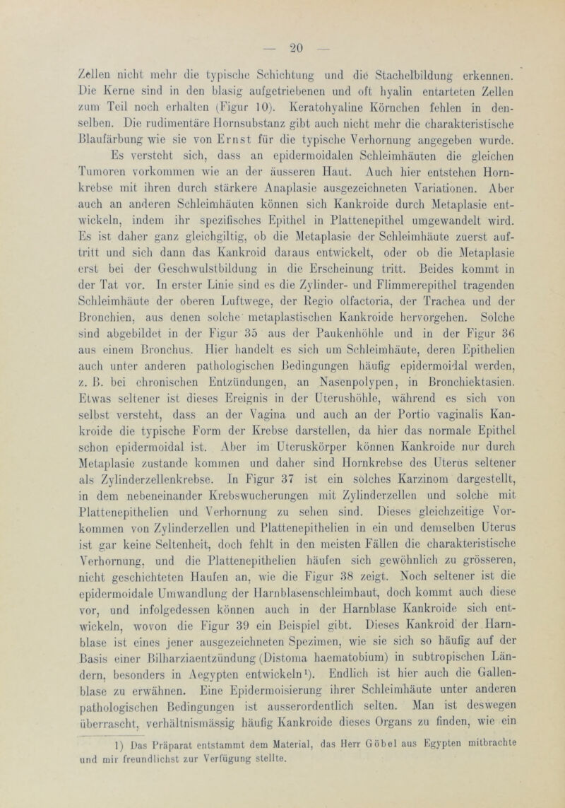 Zellen nicht mein- die typische Scliichtung und die Staclielbildung erkennen. Die Kerne sind in den blasig aul'getriebenen und oft hyalin entarteten Zellen zum Teil noch erhalten (Figur 10). Keratohyaliue Körnchen fehlen in den- selben. Die rudimentäre llornsubstanz gibt auch nicht mehr die charakteristische Blaufärbung wie sie von Eni st für die typische Verhornung angegeben wurde. Es verstellt sich, dass an epidermoidalen Schleimhäuten die gleichen Tumoren Vorkommen Avie an der äusseren Haut. Auch hier entstehen Horn- krebse mit ihren durch stärkere Anaplasie ausgezeichneten Variationen. Aber auch an anderen Schleimhäuten können sich Kankroide durcli Metaplasie ent- wickeln, indem ihr spezifisches Epithel in Plattenepithel umgewandelt wird. Es ist daher ganz gleichgiltig, ob die Metaplasie der Schleimhäute zuerst auf- tritt und sich dann das Kankroid daraus entwickelt, oder ob die Metaplasie erst bei der Geschwulstbildung in die Erscheinung tritt. Beides kommt in der Tat vor. In erster Linie sind es die Zylinder- und Flimmerepithel tragenden Schleimhäute der oberen Luftwege, der Regio olfactoria, der Trachea und der Bronchien, aus denen solche metaplastischen Kankroide liervorgehen. Solche sind abgebildet in der Figui' 35 aus der Paukenhöhle und in der Figur 36 aus einem Bronchus. Hier handelt es sich um Schleimhäute, deren Epithelien auch unter anderen pathologischen Bedingungen häufig epidermoidal werden, z. B. bei clironischen Entzündungen, an Nasenpolypen, in Bronchiektasien. Etwas seltener ist dieses Ereignis in der Lterushöhle, während es sich von selbst versteht, dass an der Vagina und auch an der Portio vaginalis Kan- kroide die typische Form der Krebse darstellen, da hier das normale Epithel schon epidermoidal ist. Aber im üteruskörper können Kankroide nur durch Metaplasie zustande kommen und daher sind Hornkrebse des Uterus seltener als Zylinderzellenkrebse. In Figur 37 ist ein solches Karzinom dargestellt, in dem nebeneinander Krebswucherungen mit Zylinderzellen und solche mit Plattenepithelien und Verhornung zu sehen sind. Dieses gleichzeitige Vor- kommen von Zylinderzellen und Plattenepithelien in ein und demselben Uterus ist gar keine Seltenheit, doch fehlt in den meisten Fällen die charakteristische Verhornung, und die Plattenepithelien häufen sich gewöhnlich zu grösseren, nicht geschichteten Haufen an, wie die Figur 38 zeigt. Noch seltener ist die epidermoidale Umwandlung der Harnblasenschleimhaut, doch kommt aucli diese vor, und infolgedessen können auch in der Harnblase Kankroide sich ent- wickeln, wovon die Figur 39 ein Beispiel gibt. Dieses Kankroid der Harn- blase ist eines jener ausgezeichneten Spezimen, wie sie sich so häufig auf der Basis einer Bilharziaentzündung (Distoma haematobium) in subtropischen Län- dern, besonders in Aegypten entwickeln L- Endlich ist hier aucli die Gallen- blase zu erwähnen. Eine Epidermoisierung ihrer Schleimhäute unter anderen pathologischen Bedingungen ist ausserordentlicli selten. Man ist deswegen überrascht, verhältnismässig häufig Kankroide dieses Organs zu finden, wie ein 1) Das Präparat entstammt dem Material, das Herr Göbol aus Egypten mitbraclile und mir freundliclist zur Verfügung stellte.