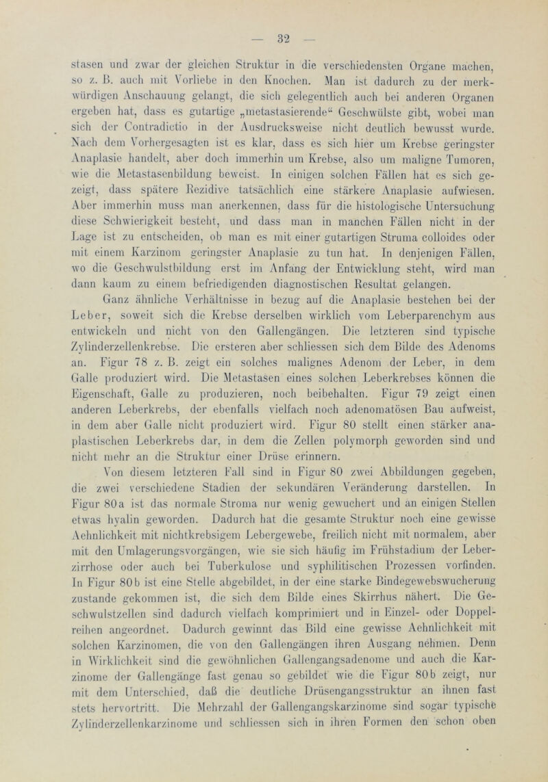 stasen und zwar der gleicdien Struktur in die verschiedensten Organe machen, so z. B. aucli mit Vorliebe in den Knoclien. Man ist dadurcli zu der merk- würdigen Anschauung gelangt, die sich gelegentlich auch bei anderen Organen ergeben hat, dass es gutartige „metastasierende“ Geschwülste gibt, wobei man sich der Contradictio in der Ausdrucksweise nicht deutlich bewusst wurde. Nach dem Vorhergesagten ist es klar, dass es sich hier um Krebse geringster Anaplasie handelt, aber doch immerhin um Krebse, also um maligne Tumoren, wie die Metastasenbildung beweist. In einigen solchen Fällen hat es sich ge- zeigt, dass spätere Kezidive tatsächlich eine stärkere Anaplasie aufwiesen. Aber immeidiin muss man anerkennen, dass für die histologische Untersuchung diese Schwierigkeit besteht, und dass man in manchen Fällen nicht in der Lage ist zu entscheiden, ob man es mit einer gutartigen Struma colloides oder mit einem Karzinom geringster Anaplasie zu tun hat. In denjenigen Fällen, wo die Geschwulstbildung erst im Anfang der Entwicklung steht, wird man dann kaum zu einem befriedigenden diagnostischen Resultat gelangen. Ganz ähnliche Verhältnisse in bezug auf die Anaplasie bestehen bei der Leber, soweit sich die Krebse derselben wirklich vom Leberparenchym aus entwickeln und nicht von den Gallengängen. Die letzteren sind typische Zylinderzellenkrebse. Die ersteren aber schliessen sich dem Bilde des Adenoms an. Figur 78 z. B. zeigt ein solches malignes Adenom der Leber, in dem Galle produziert wird. Die Metastasen eines solchen Leberkrebses können die Eigenschaft, Galle zu produzieren, noch beibehalten. Figur 79 zeigt einen anderen Leberkrebs, der ebenfalls vielfach noch adenomatösen Bau aufweist, in dem aber Galle nicht produziert wird. Figur 80 stellt einen stärker ana- plastischen Leberkrebs dar, in dem die Zellen polymorph geworden sind und nicht mehr an die Struktur einer Drüse erinnern. Von diesem letzteren Fall sind in Figur 80 zAvei Abbildungen gegeben, die zwei verschiedene Stadien der sekundären Veränderung darstellen. In Figur 80a ist das normale Stroma nur wenig gewuchert und an einigen Stellen etwas hyalin geworden. Dadurch hat die gesamte Struktur noch eine gewisse xVehnlichkeit mit nichtkrebsigem Lebergewebe, freilich nicht mit normalem, aber mit den Umlagerungsvorgängen, wie sie sich häufig im Frühstadium der Leber- zirrhose oder auch bei Tuberkulose und syphilitischen Prozessen vorfinden. In Figur 80b ist eine Stelle abgebildet, in der eine starke Bindegewebswucherung zustande gekommen ist, die sich dem Bilde eines Skirrhus nähert. Die Ge- schwulstzellen sind dadurch vielfach komprimiert und in Einzel- oder Doppel- reihen angeordnet. Dadurch gewinnt das Bild eine gewisse Aehnlichkeit mit solchen Karzinomen, die von den Gallengängen ihren Ausgang nehmen. Denn in Wirklichkeit sind die gewöhnlichen Gallengangsadenome und auch die Kar- zinome der Gallengänge fast genau so gebildet wie die Figur SOb zeigt, nur mit dem Unterschied, daß die deutliche Drüsengangsstruktur an ihnen fast stets hervortritt. Die Mehrzahl der Gallengangskarzinome sind sogar typischb Zylindcrzcllenkarzinome und schliessen sich in ihren Formen den schon oben