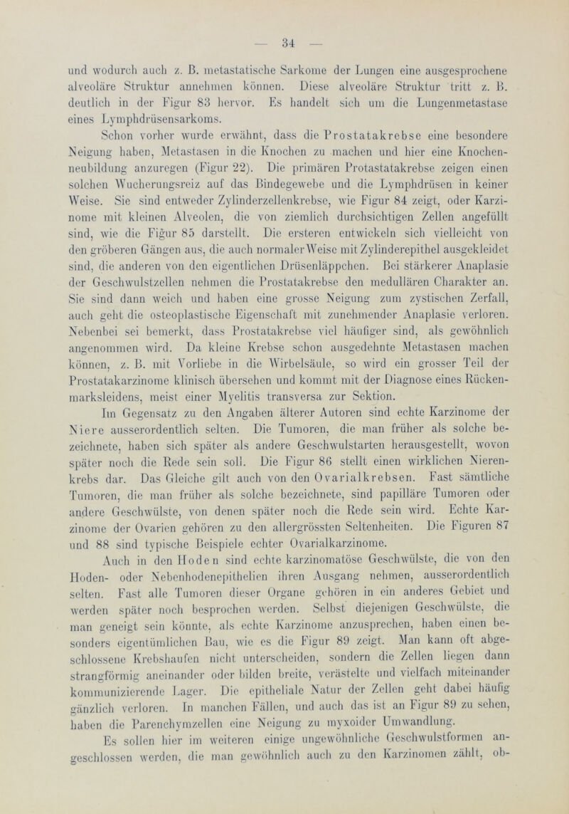 und wodurch auch z. ß. luetasiatische Sarkome der Lungen eine ausgesprochene alveoläre Struktur aunehiiien können. Diese alveoläre Struktur tritt z. ß. deutlich in der Figur 83 liervor. Es handelt sich um die Lungenmetastase eines J.,ymphdrüsensarkoms. Schon vorher wurde erwähnt, dass die ßrostatakrebse eine besondere Neigung haben, Metastasen in die Knochen zu machen und hier eine Knochen- neubildung anzuregen (Figur 22). Die primären ßrotastatakrebse zeigen einen solchen Wucherungsreiz auf das ßindegewebe und die Lymphdrüsen in keiner Weise. Sie sind entweder Zylinderzcllenkrebse, wie Figur 84 zeigt, oder Karzi- nome mit kleinen Alveolen, die von ziemlich durchsichtigen Zellen angefüllt sind, wie die Figur 85 darstcllt. Die ersteren entwickeln sich vielleicht von den gröberen Gängen aus, die auch normaler Weise mit Zylinderepithel ausgekleidet sind, die anderen von den eigentlichen Drüsenläppchen, ßei stärkerer Anaplasie der Geschwulstzellen nehmen die Prostatakrebse den medullären Charakter an. Sie sind dann weich und haben eine grosse Neigung zum zystischen Zerfall, auch geht die osteoplastische Eigenschaft mit zunehmender Anaplasie verloren. Nebenbei sei bemerkt, dass Prostatakrebse viel häufiger sind, als gewöhnlich angenommen wird. Da kleine Krebse schon ausgedehnte Metastasen machen können, z. ß. mit Vorliebe in die Wirbelsäule, so wird ein grosser Teil der Prostatakarzinorae klinisch übersehen und kommt mit der Diagnose eines Rücken- marksleidens, meist einer Myelitis transversa zur Sektion. Im Gegensatz zu den Angaben älterer Autoren sind echte Karzinome der Niere ausserordentlich selten. Die Tumoren, die man früher als solche bc- zeichnete, haben sich später als andere Geschwulstarten herausgestellt, wovon später noch die Rede sein soll. Die Figur 86 stellt einen wirklichen Nieren- krebs dar. Das Gleiche gilt auch von den 0varialkrebsen. Fast sämtliche Tumoren, die man früher als solche bezeichnete, sind papilläre Tumoren oder andere Geschwülste, von denen später noch die Rede sein wird. Echte Kar- zinome der Ovarien gehören zu den aliergrös.sten Seltenheiten. Die Figuren 87 und 88 sind typische ßeispiele echter Ovarialkarzinome. Auch in den Hoden sind echte karzinomatösc Geschwülste, die von den Hoden- oder Nebenhodcnepithelicn ihren Ausgang nehmen, ausserordentlich selten. Fast alle Tumoren dieser Organe gehören in ein anderes Gebiet und werden später noch besprochen werden. Selbst diejenigen Geschwülste, die man geneigt sein könnte, als echte Karzinome anzusiwechen, haben einen be- sonders eigentümlichen ßau, wie es die Figur 89 zeigt. Man kann oft abge- schlossene Krebshau feil nicht unterscheiden, sondern die Zellen liegen dann strangförmig aneinander oder bilden breite, vei’ästeltc und vielfach miteinandet kommunizierende Lager. Die epitheliale Natur der Zellen geht dabei häutig gänzlich verloren. In manchen Fällen, und auch das ist an Figur 89 zu sehen, haben die Parenchymzellen eine Neigung zu myxoider Umwandlung. Es sollen hier im weiteren einige ungewöhnliche Geschwulstformen an- geschlossen werden, die man gewöhnlich auch zu den Karzinomen zalilt, ob-