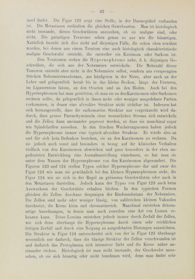 iiLsel findet. Die Figur 122 zeigt eine Stelle, in der Darniepitliel vorhanden ist. Die Metastasen enthielten die gleichen Gewehsarten. Man ist histologisch nicht imstande, diesen Geschwülsten anzusehen, oh sie maligne sind, oder nicht. Die gutartigen Teratome sehen genau so aus wie die bösartigen. Natürlich bezieht sich dies nicht auf diejenigen Fälle, die schon oben erwähnt wurden, bei denen aus einem Teratom eine auch histologisch charakteristische maligne Geschwulst entsteht, die entweder ein Karzinom oder Sarkom ist. Den Teratomen stehen die Hypernephrome nahe, d. h. diejenigen Ge- schwülste, die sich aus der Nebenniere entwickeln. Die Mehrzahl dieser Tumoren entsteht aber nicht in der Nebenniere selbst, sondern aus versprengten Stücken Nebennierensubstanz, am häufigsten in der Niere, aber auch an der T.eber und gelegentlich herab bis in das kleine Decken, längs der Ureteren, im Ligamentum latum, an den Ovarien und an den Hoden. Auch bei den llyiiernephromen hat man gestritten, ob man sie zu denKarzinomen oder Sarkomen rechnen sollte, da gelegentlich in ihnen mehr oder weniger ausgedehnte Partien Vorkommen, in denen eine alveoläre Struktur nicht sichtbar ist. Indessen hat sich hcj’ausgestellt, dass die sarkomatöse Struktur nur vorgetäuscht wird da- durch, dass grosse Parenchyminseln ohne wesentliches Stroma sich entwickeln und die Zellen dann aneinander gepresst werden, so dass sie manchmal sogar wie Spindelzellen aussehen. In den frischen Wucherungszonen haben jedoch die Ilypernephrome immer eine typisch alveoläre Struktur. Es würde also an und für sich kein Bedenken bestehen, sie zu den Karzinomen zu rechnen. Da sic jedoch auch sonst und besonders in bezug auf ihr klinisches Verhalten vielfach von den Karzinomen abweichen und ganz besonders in der eben an- gedeuteten Entwicklung eine Ausnahmestellung einnehmen, so hat man sie unter dem Namen der Ilypernephrome von den Karzinomen abgesondert. Die Phguren 123 und 124 stellen Typen solcher Ilypernephrome dar und zwar die Figur 123 wie man .sie gewöhnlich hei den kleinen Ifyperncphromcn sieht, die Figur 124 wie sic sich in der Regel an grösseren Geschwülsten oder auch in den Metastasen darstellen. Jedoch kann der Typus von Figur 123 auch beim Auswachsen der Geschwülste erhalten bleiben. In den typischen Formen gleichen die Zellen durchaus denjenigen der Rindensubstanz der Nebenniere. Die Zellen sind mehr oder weniger blasig, von zahlreichen kleinen Vakuolen dui’chsctzt, die Kerne klein und chromatinreich. Manchmal entstehen drüsen- artige Anordnungen, in denen man auch zuweilen eine Art von Lumen er- kennen kann. Diese Lumina entstehen jedoch immer durch Zerfall der Zellen, wie sich denn überhaupt die 1 lypcrne[dironic durch einen sehr reichlichen fettigen Zerfall und durch eine Neigung zu ausgedehnten Hlutungen auszeichnen. Die Struktur in Figur 124 unterscheidet sich von der in Figur 123 überhaujit wesentlich nur dadurch, dass die blasige Stiaiktur der Zellen verschwunden ist und dadurch das Proto|)lasma sich intensiver färbt und die Kerne näher an- einander rücken. Histologisch ist mau nicht imstande, der Geschwulst anzu- schen, ob sie .sich bösartig oder nicht benehmen wird, denn man findet sehr