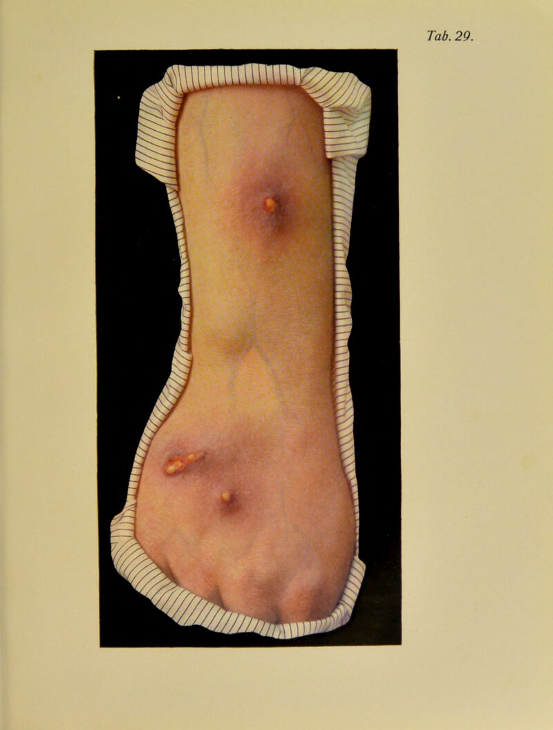 Tab. 29