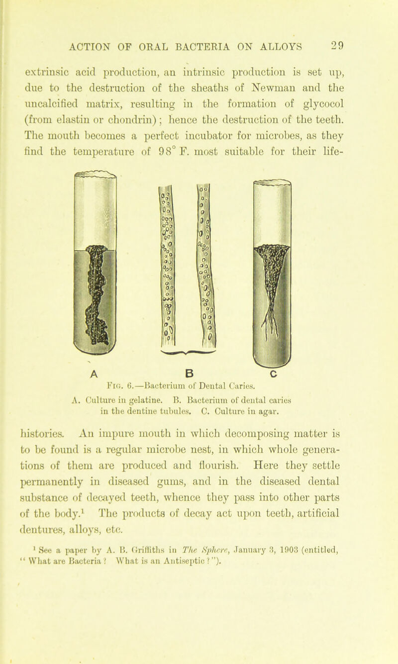 extrinsic acid production, an intrinsic production is set up, due to the destruction of the sheaths of Newman and the uncalcified matrix, resulting in the formation of glycocol (from elastin or chondrin); hence the destruction of the teeth. The mouth becomes a perfect incubator for microbes, as they find the temperature of 9 8° F. most suitable for their life- Fio. 6.—Bacterium of Dental Caries. A. Culture in gelatine. B. Bacterium of dental caries in the dentine tubules. C. Culture in agar. histories. An impure mouth in wliich decomposing matter is to be found is a regular microbe nest, in which whole genera- tions of them are produced and flourish. Here they settle permanently in diseased gums, and in the diseased dental substance of decayed teeth, whence they pass into other parts of the body.^ The products of decay act u])on teeth, artificial dentures, alloys, etc. ' See a paper by A. B. Crifiitbs in Tlix Sply'rr., .Tanuary S, 1903 (entitled, “ Wbat are Bacteria ? What is an Antiseptic ? ”). I