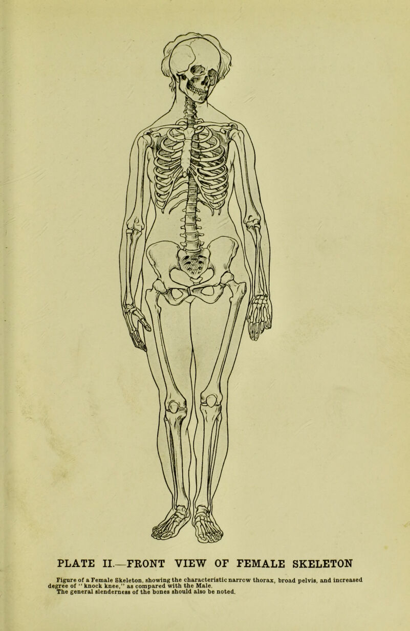 Figure of a Female Skeleton, showing the characteristic narrow thorax, broad pelvis, and increased degree of “ knock knee,” as compared with the Male. The general slenderness of the bones should also be noted.