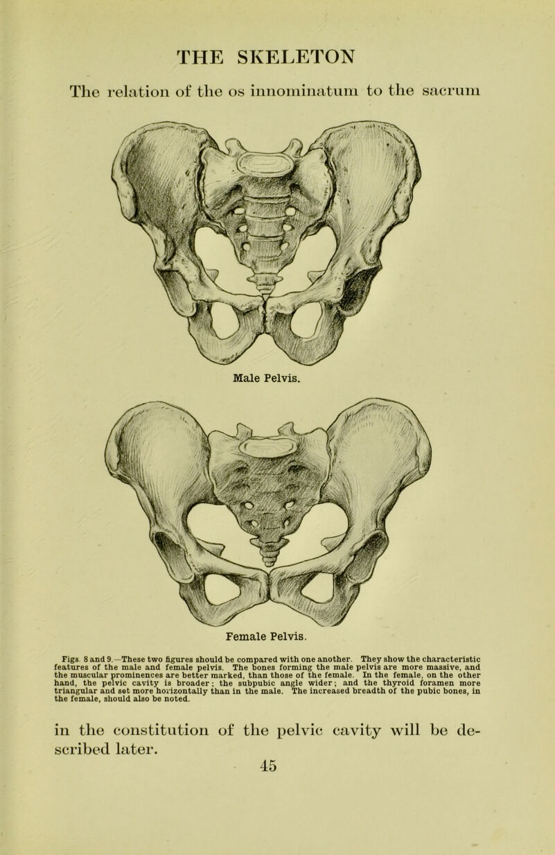 The relation of the os innominatum to the sacrum Male Pelvis. Female Pelvis. Figs 8 and 9.—These two figures should be compared with one another. They show the characteristic features of the male and female pelvis. The bones forming the male pelvis are more massive, and the muscular prominences are better marked, than those of the female. In the female, on the other hand, the pelvic cavity is broader; the subpubic angle wider; and the thyroid foramen more triangular and set more horizontally than in the male. The increased breadth of the pubic bones, in the female, should also be noted. in the constitution of the pelvic cavity will be de- scribed later.