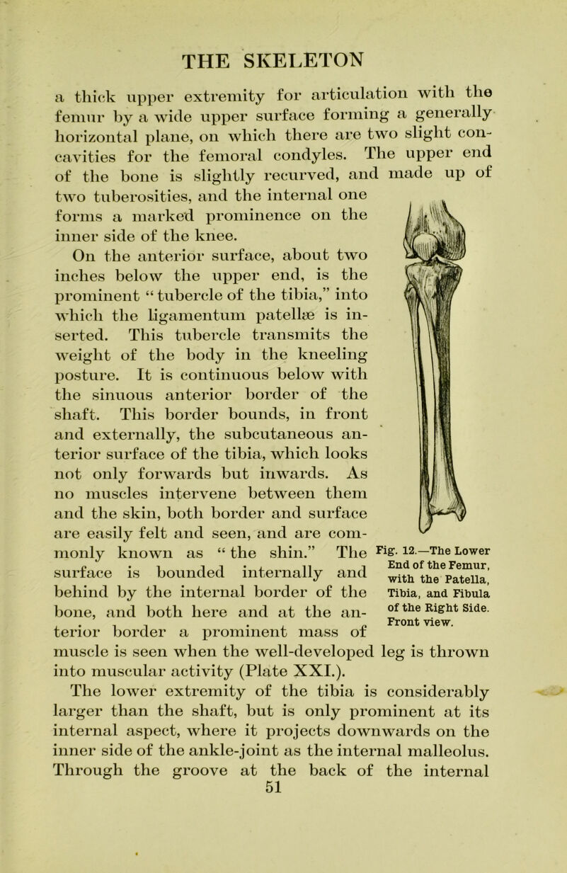 a thick upper extremity for articulation with the femur by a wide upper surface forming a generally horizontal plane, on which there are two slight con- cavities for the femoral condyles. The upper end of the bone is slightly recurved, and made up of two tuberosities, and the internal one forms a marked prominence on the inner side of the knee. On the anterior surface, about two inches below the upper end, is the prominent “ tubercle of the tibia,” into which the ligamentum patelke is in- serted. This tubercle transmits the weight of the body in the kneeling posture. It is continuous below with the sinuous anterior border of the shaft. This border bounds, in front and externally, the subcutaneous an- terior surface of the tibia, which looks not only forwards but inwards. As no muscles intervene between them and the skin, both border and surface are easily felt and seen, and are com- monly known as “ the shin.” The Fi&-12.—The Lower surtace is bounded internally and with the Patella behind by the internal border of the Tihia, and Fibula bone, and both here and at the an- of the Rlght Slde- 1 1 . , £ Front view. tenor border a prominent mass o± muscle is seen when the well-developed leg is thrown into muscular activity (Plate XXI.). The lower extremity of the tibia is considerably larger than the shaft, but is only prominent at its internal aspect, where it projects downwards on the inner side of the ankle-joint as the internal malleolus. Through the groove at the back of the internal