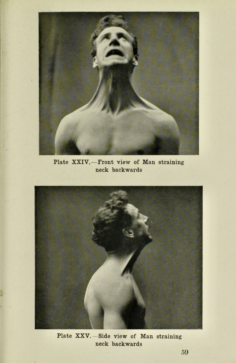 Plate XXIV.—Front view of Man straining neck backwards Plate XXV.—Side view of Man straining neck backwards