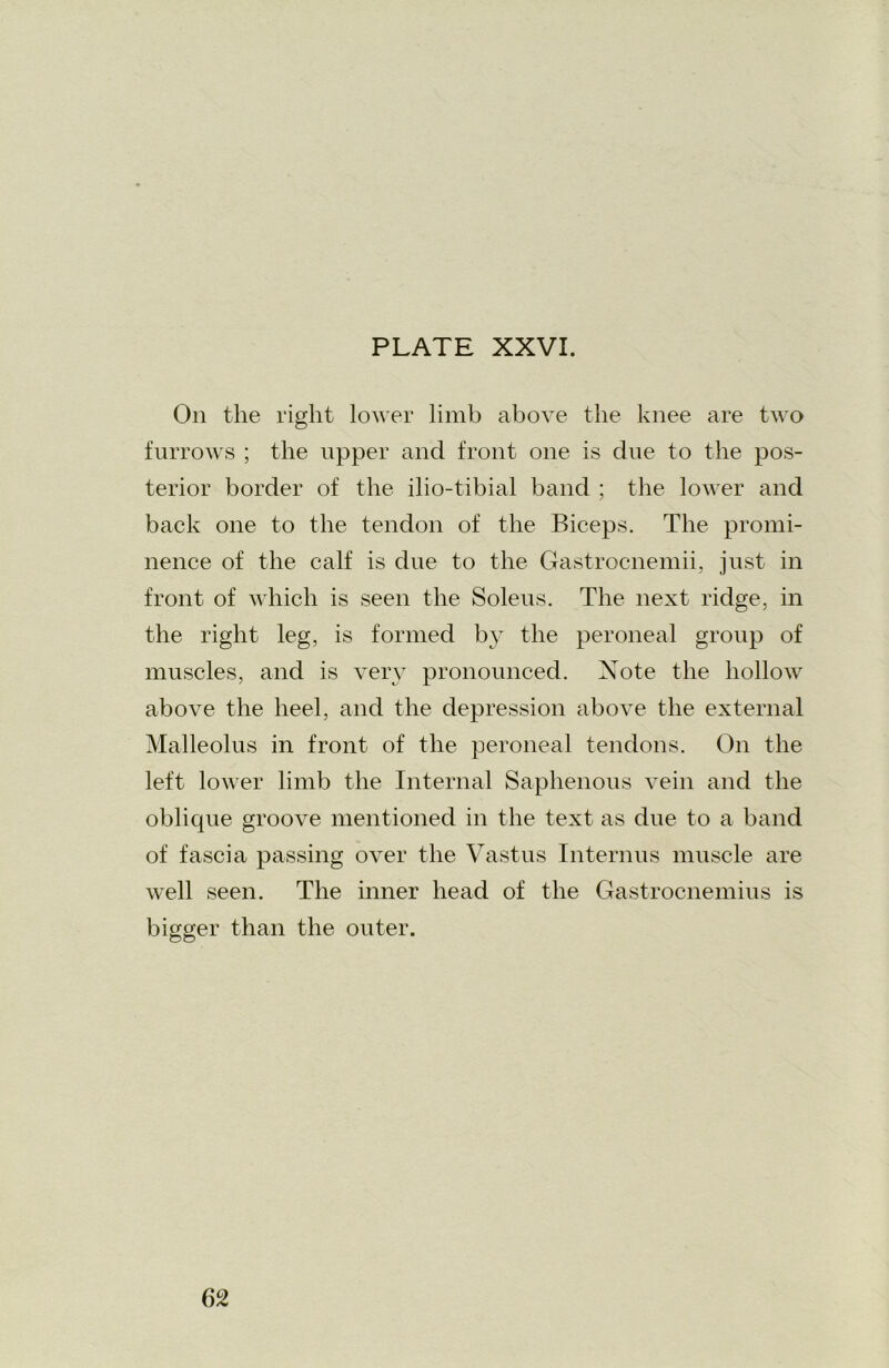 On the right lower limb above the knee are two furrows ; the upper and front one is due to the pos- terior border of the ilio-tibial band ; the lower and back one to the tendon of the Biceps. The promi- nence of the calf is due to the Gastrocnemii, just in front of which is seen the Soleus. The next ridge, in the right leg, is formed by the peroneal group of muscles, and is very pronounced. Note the hollow above the heel, and the depression above the external Malleolus in front of the peroneal tendons. On the left lower limb the Internal Saphenous vein and the oblique groove mentioned in the text as due to a band of fascia passing over the Vastus Interims muscle are well seen. The inner head of the Gastrocnemius is bigger than the outer. 6°2