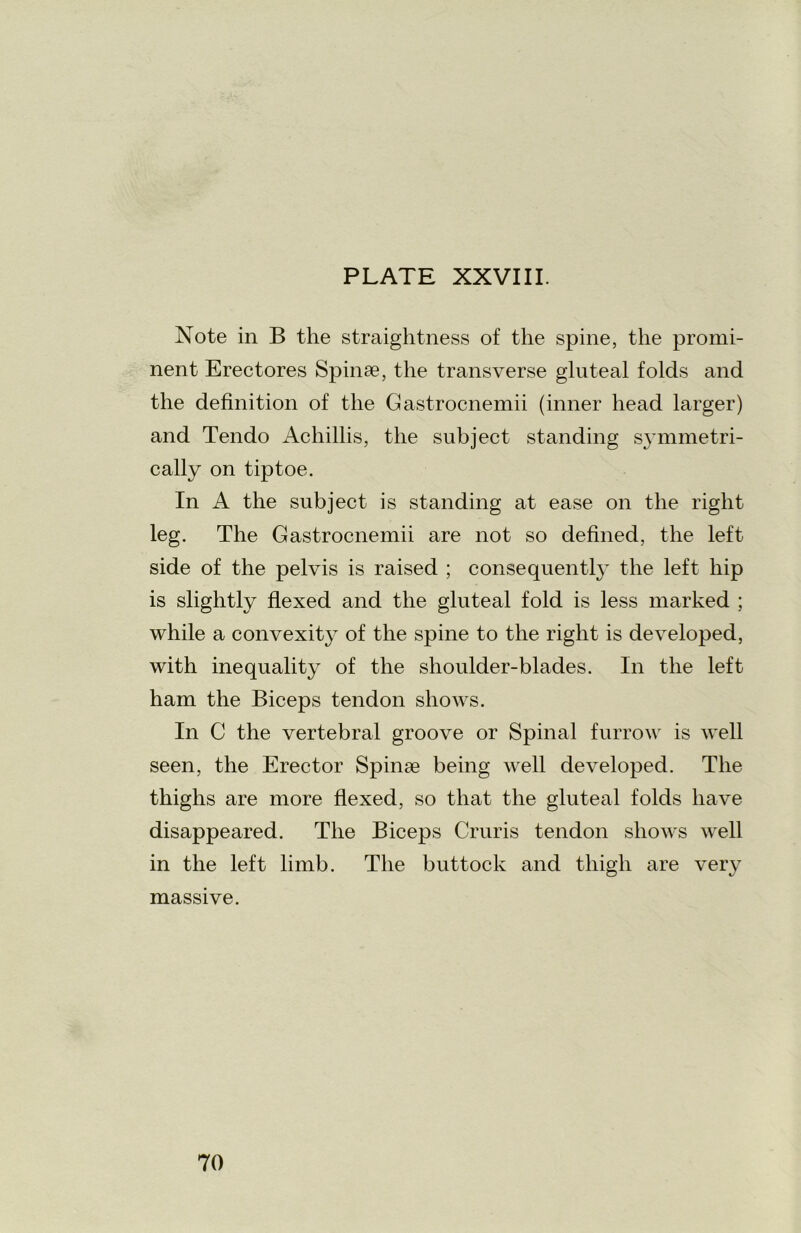 Note in B the straightness of the spine, the promi- nent Erectores Spinse, the transverse gluteal folds and the definition of the Gastrocnemii (inner head larger) and Tendo Achillis, the subject standing s}Tmmetri- cally on tiptoe. In A the subject is standing at ease on the right leg. The Gastrocnemii are not so defined, the left side of the pelvis is raised ; consequentl}- the left hip is slightly flexed and the gluteal fold is less marked ; while a convexity of the spine to the right is developed, with inequality of the shoulder-blades. In the left ham the Biceps tendon shows. In C the vertebral groove or Spinal furrow is well seen, the Erector Spinse being well developed. The thighs are more flexed, so that the gluteal folds have disappeared. The Biceps Cruris tendon shows well in the left limb. The buttock and thigh are very massive.