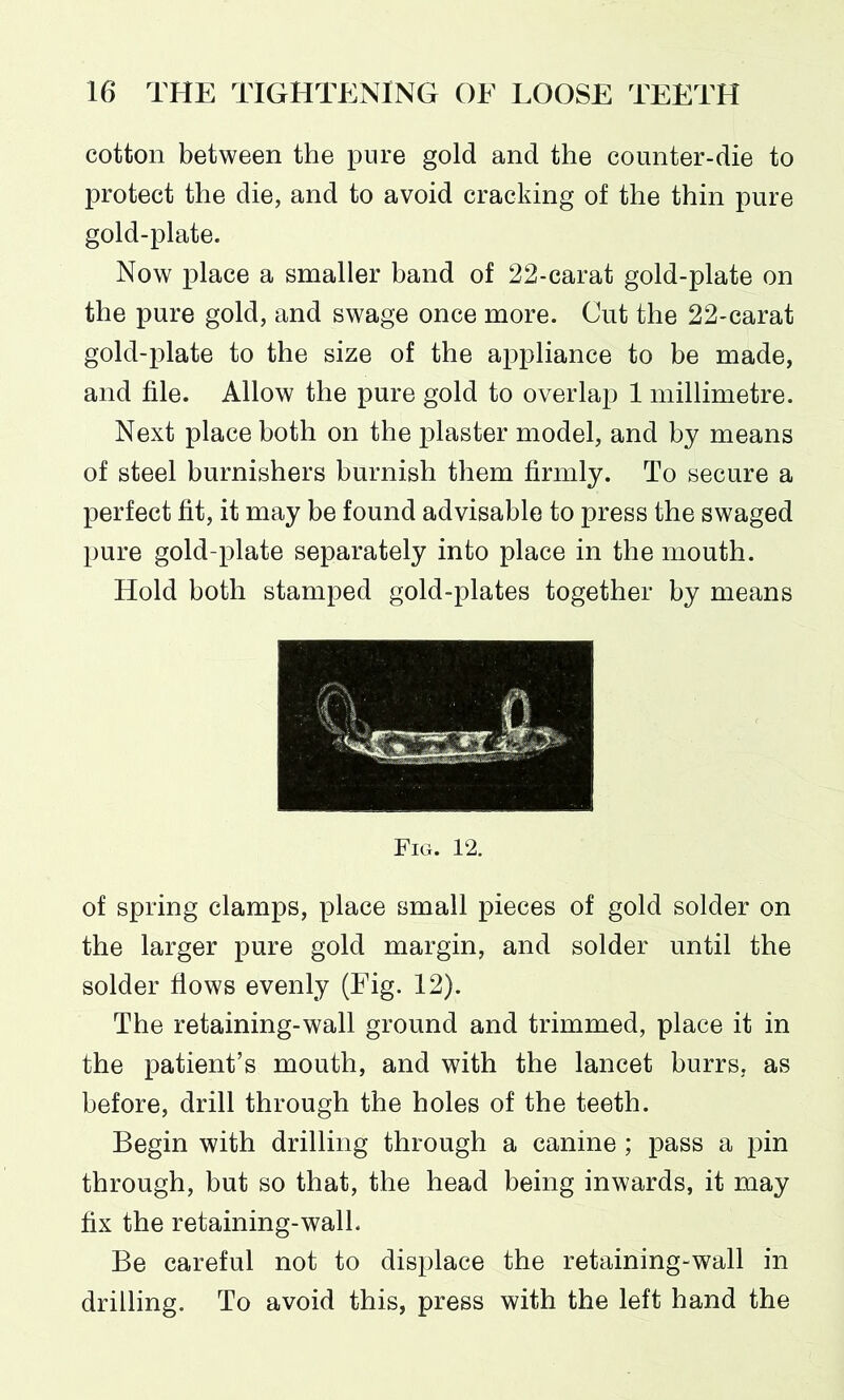 cotton between the pure gold and the counter-die to protect the die, and to avoid cracking of the thin pure gold-plate. Now place a smaller band of 22-carat gold-plate on the pure gold, and swage once more. Cut the 22-carat gold-plate to the size of the appliance to be made, and file. Allow the pure gold to overlap 1 millimetre. Next place both on the plaster model, and by means of steel burnishers burnish them firmly. To secure a perfect fit, it may be found advisable to press the swaged pure gold-plate separately into place in the mouth. Hold both stamped gold-plates together by means Fig. 12. of spring clamps, place small pieces of gold solder on the larger pure gold margin, and solder until the solder flows evenly (Fig. 12). The retaining-wall ground and trimmed, place it in the patient’s mouth, and with the lancet burrs, as before, drill through the holes of the teeth. Begin with drilling through a canine ; pass a pin through, but so that, the head being inwards, it may fix the retaining-wall. Be careful not to displace the retaining-wall in drilling. To avoid this, press with the left hand the