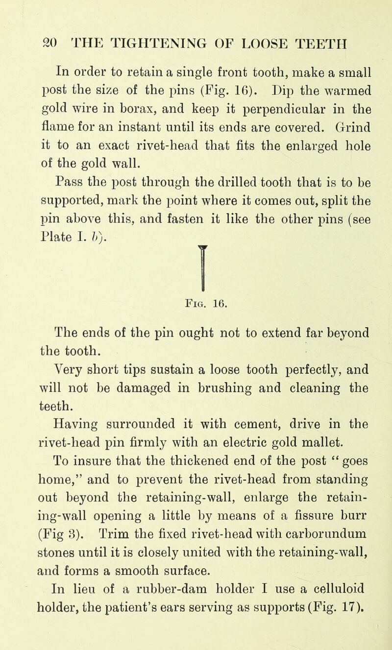 In order to retain a single front tooth, make a small post the size of the pins (Fig. 16). Dip the warmed gold wire in borax, and keep it perpendicular in the flame for an instant until its ends are covered. Grind it to an exact rivet-head that fits the enlarged hole of the gold wall. Pass the post through the drilled tooth that is to be supported, mark the point where it comes out, split the pin above this, and fasten it like the other pins (see Plate I. b). } Fig. 16. The ends of the pin ought not to extend far beyond the tooth. Very short tips sustain a loose tooth perfectly, and will not be damaged in brushing and cleaning the teeth. Having surrounded it with cement, drive in the rivet-head pin firmly with an electric gold mallet. To insure that the thickened end of the post “ goes home,” and to prevent the rivet-head from standing out beyond the retaining-wall, enlarge the retain- ing-wall opening a little by means of a fissure burr (Fig 8). Trim the fixed rivet-head with carborundum stones until it is closely united with the retaining-wall, and forms a smooth surface. In lieu of a rubber-dam holder I use a celluloid holder, the patient’s ears serving as supports (Fig. 17).