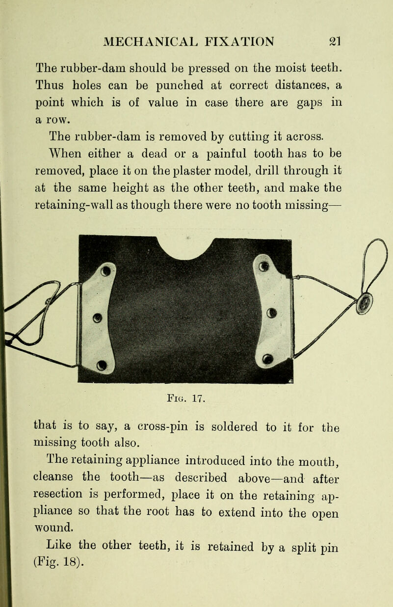 The rubber-dam should be pressed on the moist teeth. Thus holes can be punched at correct distances, a point which is of value in case there are gaps in a row. The rubber-dam is removed by cutting it across. When either a dead or a painful tooth has to be removed, place it on the plaster model, drill through it at the same height as the other teeth, and make the retaining-wall as though there were no tooth missing— Fig. 17. that is to say, a cross-pin is soldered to it for the missing tooth also. The retaining appliance introduced into the mouth, cleanse the tooth—as described above—and after resection is performed, place it on the retaining ap- pliance so that the root has to extend into the open wound. Like the other teeth, it is retained by a split pin (Fig. 18).