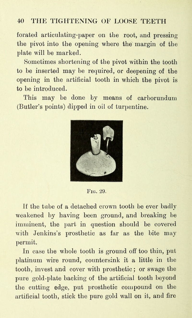 forated articulating-paper on the root, and pressing the pivot into the opening where the margin of the plate will be marked. Sometimes shortening of the pivot within the tooth to be inserted may be required, or deepening of the opening in the artificial tooth in which the pivot is to be introduced. This may be done by means of carborundum (Butler’s points) dipped in oil of turpentine. Fig. 29. If the tube of a detached crown tooth be ever badly weakened by having been ground, and breaking be imminent, the part in question should be covered with Jenkins’s prosthetic as far as the bite may permit. In case the whole tooth is ground off too thin, put platinum wire round, countersink it a little in the tooth, invest and cover with prosthetic; or swage the pure gold-plate backing of the artificial tooth beyond the cutting edge, put prosthetic compound on the artificial tooth, stick the pure gold wall on it, and fire