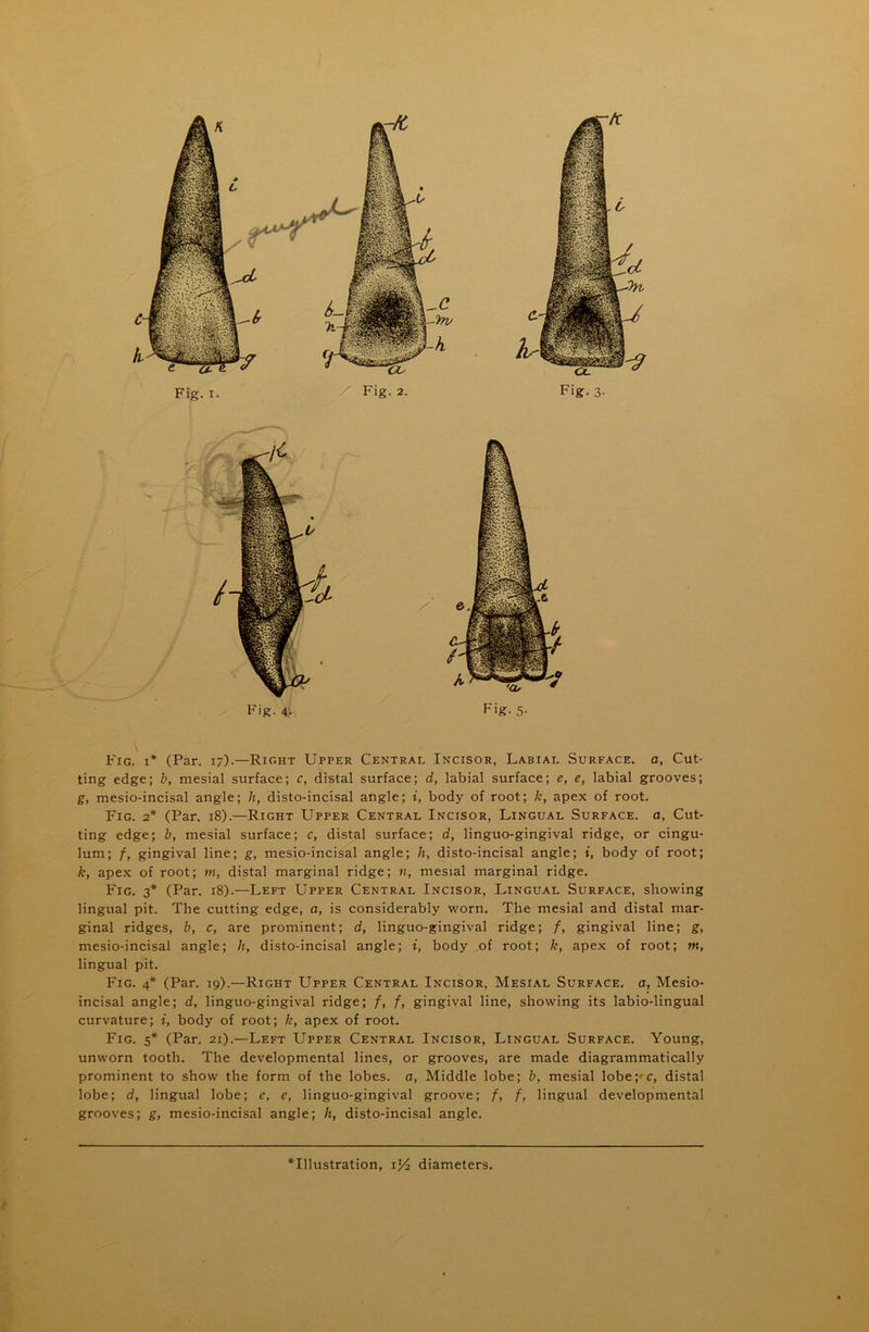 Fig. 1* (Par. 17).—Right Upper Central Incisor, Labial Surface, a, Cut- ting edge; b, mesial surface; c, distal surface; d, labial surface; e, e, labial grooves; g, mesio-incisal angle; h, disto-incisal angle; i, body of root; k, apex of root. Fig. 2* (Par. 18).—Right Upper Central Incisor, Lingual Surface, a, Cut- ting edge; b, mesial surface; c, distal surface; d, linguo-gingival ridge, or cingu- lum; /, gingival line; g, mesio-incisal angle; h, disto-incisal angle; i, body of root; k, apex of root; m, distal marginal ridge; n, mesial marginal ridge. Fig. 3* (Par. 18).—Left Upper Central Incisor, Lingual Surface, showing lingual pit. The cutting edge, a, is considerably worn. The mesial and distal mar- ginal ridges, b, c, are prominent; d, linguo-gingival ridge; f, gingival line; g, mesio-incisal angle; h, disto-incisal angle; i, body of root; k, apex of root; m, lingual pit. Fig. 4* (Par. 19).—Right Upper Central Incisor, Mesial Surface, a, Mesio- incisal angle; d, linguo-gingival ridge; f, f, gingival line, showing its labio-lingual curvature; i, body of root; k, apex of root. Fig. 5* (Par. 21).—Left Upper Central Incisor, Lingual Surface. Young, unworn tooth. The developmental lines, or grooves, are made diagrammatically prominent to show the form of the lobes, a, Middle lobe; b, mesial lobe pc, distal lobe; d, lingual lobe; e, e, linguo-gingival groove; f, f, lingual developmental grooves; g, mesio-incisal angle; It, disto-incisal angle.