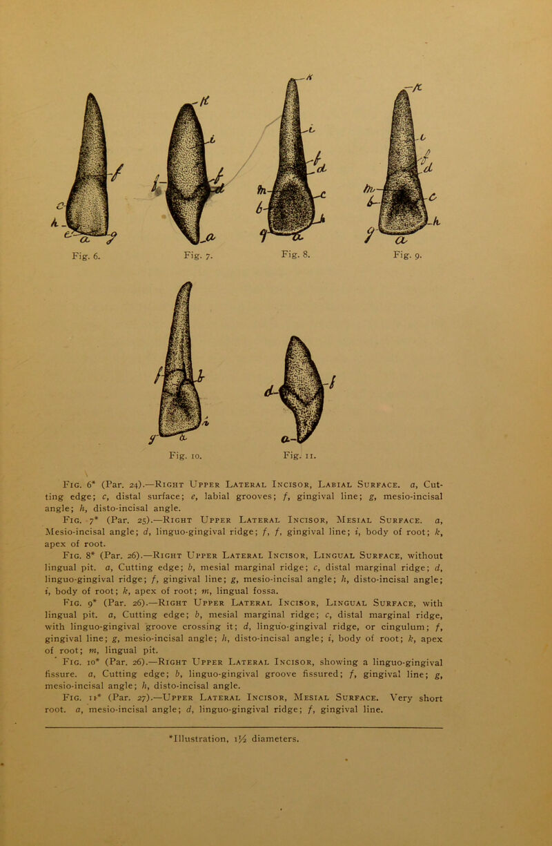 Fig. 6* (Par. 24).—Right Upper Lateral Incisor, Labial Surface, a. Cut- ting edge; c, distal surface; e, labial grooves; f, gingival line; g, mesio-incisal angle; h, disto-incisal angle. Fig. 7* (Par. 25).—Right Upper Lateral Incisor, Mesial Surface, a, Mesio-incisal angle; d, linguo-gingival ridge; f, f, gingival line; i, body of root; k, apex of root. Fig. 8* (Par. 26).—Right Upper Lateral Incisor, Lingual Surface, without lingual pit. a, Cutting edge; b, mesial marginal ridge; c, distal marginal ridge; d, linguo-gingival ridge; f, gingival line; g, mesio-incisal angle; h, disto-incisal angle; i, body of root; k, apex of root; m, lingual fossa. Fig. 9* (Par. 26).—Right Upper Lateral Incisor, Lingual Surface, with lingual pit. a. Cutting edge; b, mesial marginal ridge; c, distal marginal ridge, with linguo-gingival groove crossing it; d, linguo-gingival ridge, or cingulum; f, gingival line; g, mesio-incisal angle; h, disto-incisal angle; i, body of root; k, apex of root; m, lingual pit. Fig. io* (Par. 26).—Right Upper Lateral Incisor, showing a linguo-gingival fissure. 0, Cutting edge; b, linguo-gingival groove fissured; f, gingival line; g, mesio-incisal angle; It, disto-incisal angle. Fig. ii* (Par. 27).—Upper Lateral Incisor, Mesial Surface. Very short root, a, mesio-incisal angle; d, linguo-gingival ridge; f, gingival line.