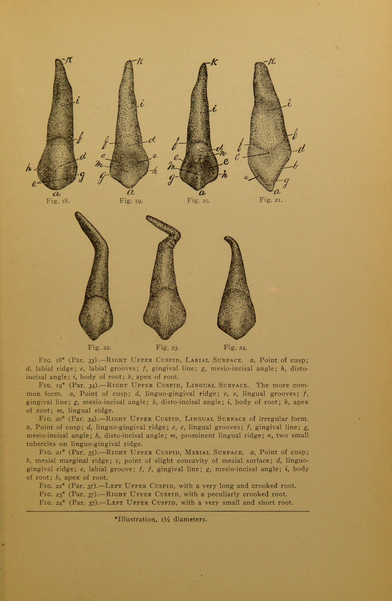 Fig. 18* (Par. 33).—Right Upper Cuspid, Labial Surface, a, Point of cusp; d, labial ridge; e, labial grooves; f, gingival line; g, mesio-incisal angle; li, disto- incisal angle; i, body of root; k, apex of root. Fig. 19* (Par. 34).—Right Upper Cuspid, Lingual Surface. The more com- mon form, a, Point of cusp; d, linguo-gingival ridge; e, e, lingual grooves; /, gingival line; g, mesio-incisal angle; h, disto-incisal angle; i, body of root; k, apex of root; m, lingual ridge. Fig. 20* (Par. 34).—Right Upper Cuspid, Lingual Surface of irregular form. a, Point of cusp; d, linguo-gingival ridge; e, e, lingual grooves; f, gingival line; g, rtiesio-incisal angle; li, disto-incisal angle; m, prominent lingual ridge; n, two small tubercles on linguo-gingival ridge. Fig. 21* (Par. 35).—Right Upper Cuspid, Mesial Surface, a, Point of cusp; b, mesial marginal ridge; c, point of slight concavity of mesial surface; d, linguo- gingival ridge; e, labial groove; f, f, gingival line; g, mesio-incisal angle; i, body of root; k, apex of root. Fig. 22* (Par. 37).—Left Upper Cuspid, with a very long and crooked root. Fig. 23* (Par. 37).—Right Upper Cuspid, with a peculiarly crooked root. Fig. 24* (Par. 37).—Left Upper Cuspid, with a very small and short root. CO Fig. 18. Fig. 19. Fig. 20. Fig. 21.