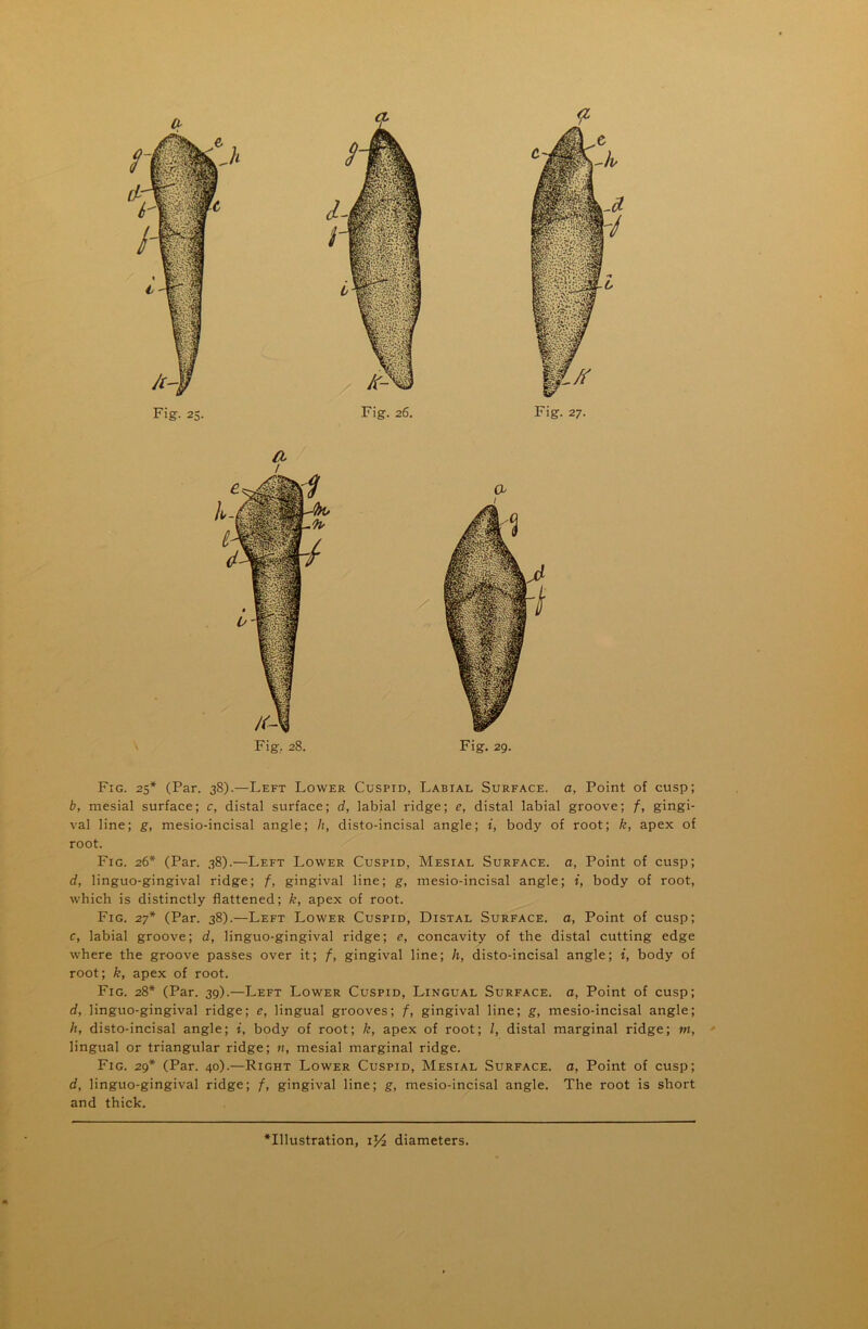 / Fig,. 28. Fig. 29. Fig. 25* (Par. 38).—Left Lower Cuspid, Labial Surface, a, Point of cusp; b, mesial surface; c, distal surface; d, labial ridge; e, distal labial groove; f, gingi- val line; g, mesio-incisal angle; h, disto-incisal angle; i, body of root; k, apex of root. Fig. 26* (Par. 38).—Left Lower Cuspid, Mesial Surface, o, Point of cusp; d, linguo-gingival ridge; f, gingival line; g, mesio-incisal angle; i, body of root, which is distinctly flattened; k, apex of root. Fig. 27* (Par. 38).—Left Lower Cuspid, Distal Surface, a, Point of cusp; c, labial groove; d, linguo-gingival ridge; e, concavity of the distal cutting edge where the groove passes over it; f, gingival line; h, disto-incisal angle; i, body of root; k, apex of root. Fig. 28* (Par. 39).—Left Lower Cuspid, Lingual Surface, a, Point of cusp; d, linguo-gingival ridge; e, lingual grooves; f, gingival line; g, mesio-incisal angle; h, disto-incisal angle; i, body of root; k, apex of root; /, distal marginal ridge; m, lingual or triangular ridge; n, mesial marginal ridge. Fig. 29* (Par. 40).—Right Lower Cuspid, Mesial Surface, a, Point of cusp; d, linguo-gingival ridge; f, gingival line; g, mesio-incisal angle. The root is short and thick.