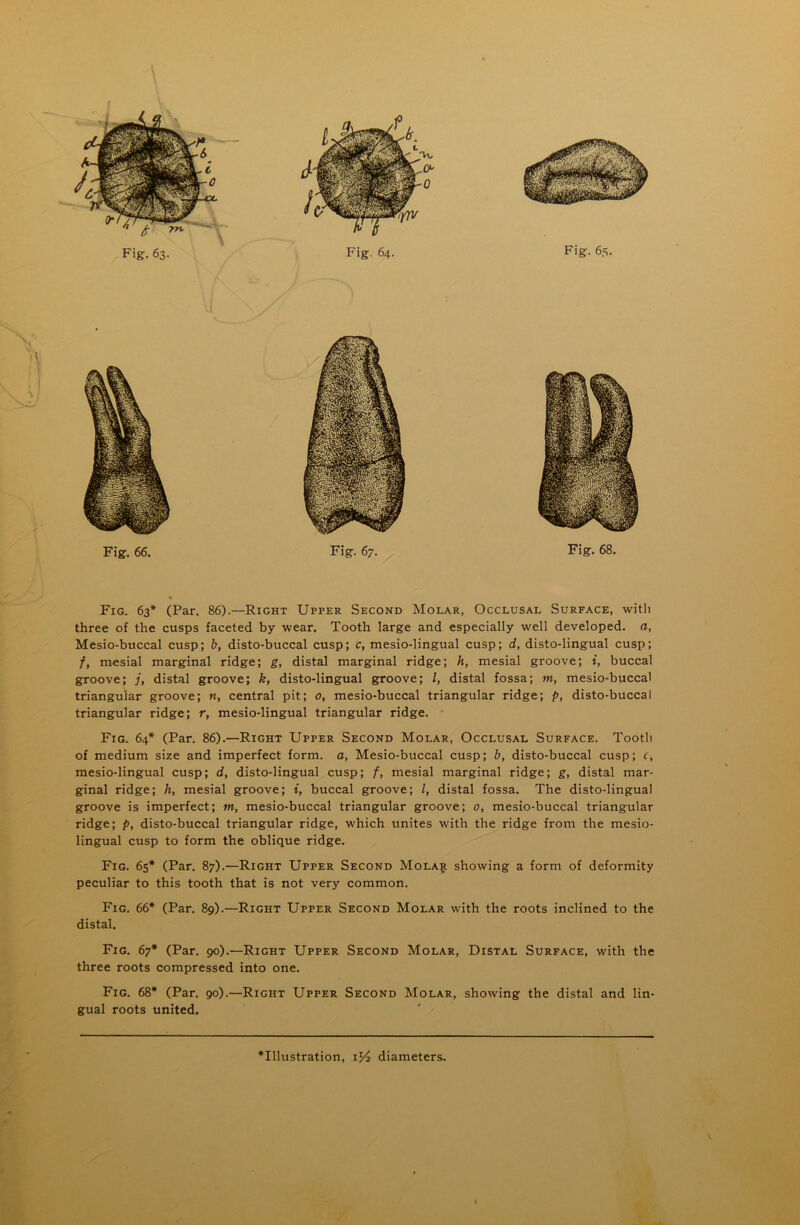 Fig. 63* (Par. 86).—Right Upper Second Molar, Occlusal Surface, with three of the cusps faceted by wear. Tooth large and especially well developed, a, Mesio-buccal cusp; b, disto-buccal cusp; c, mesio-lingual cusp; d, disto-lingual cusp; f, mesial marginal ridge; g, distal marginal ridge; h, mesial groove; i, buccal groove; /, distal groove; k, disto-lingual groove; l, distal fossa; m, mesio-buccal triangular groove; n, central pit; o, mesio-buccal triangular ridge; p, disto-buccal triangular ridge; r, mesio-lingual triangular ridge. Fig. 64* (Par. 86).—Right Upper Second Molar, Occlusal Surface. Tooth of medium size and imperfect form, a, Mesio-buccal cusp; b, disto-buccal cusp; c, mesio-lingual cusp; d, disto-lingual cusp; f, mesial marginal ridge; g, distal mar- ginal ridge; li, mesial groove; i, buccal groove; /, distal fossa. The disto-lingual groove is imperfect; m, mesio-buccal triangular groove; 0, mesio-buccal triangular ridge; p, disto-buccal triangular ridge, which unites with the ridge from the mesio- lingual cusp to form the oblique ridge. Fig. 65* (Par. 87).—Right Upper Second Mola$ showing a form of deformity peculiar to this tooth that is not very common. Fig. 66* (Par. 89).—Right Upper Second Molar with the roots inclined to the distal. Fig. 67* (Par. 90).—Right Upper Second Molar, Distal Surface, with the three roots compressed into one. Fig. 68* (Par. 90).—Right Upper Second Molar, showing the distal and lin- gual roots united. Fig. 64. Fig. 65.