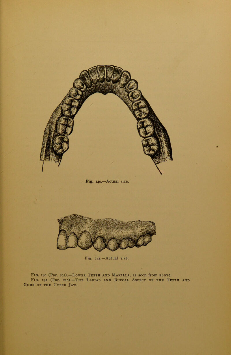 Fig. 140.—Actual size. » Fig. 141.—Actual size. Fig. 140 (Par. 202).—Lower Teeth and Maxilla, as seen from above. Fig. 141 (Par. 210).—The Labial and Buccal Aspect of the Teeth and Gums of the Upper Jaw. *