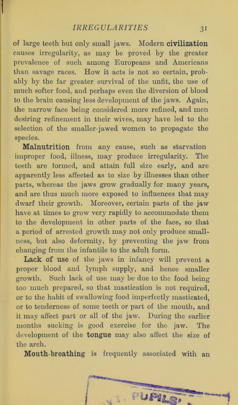 I of large teeth but only small jaws. Modern civilization causes irregularity, as may be proved by the greater prevalence of such among Europeans and Americans than savage races. How it acts is not so certain, prob- ably by the far greater survival of the unfit, the use of much softer food, and perhaps even the diversion of blood to the brain causing less development of the jaws. Again, the narrow face being considered more refined, and men desiring refinement in their wives, may have led to the selection of the smaller-jawed women to propagate the species. Malnutrition from any cause, such as starvation improper food, illness, may produce irregularity. The teeth are formed, and attain full size early, and are apparently less affected as to size by illnesses than other parts, whereas the jaws grow gradually for many years, and are thus much more exposed to influences that may dwarf their growth. Moreover, certain parts of the jaw have at times to grow very rapidly to accommodate them to the development in other parts of the face, so that a period of arrested growth may not only produce small- ness, but also deformity, by preventing the jaw from changing from the infantile to the adult form. Lack of use of the jaws in infancy will prevent a proper blood and lymph supply, and hence smaller growth. Such lack of use may be due to the food being too much prepared, so that mastication is not required, or to the habit of swallowing food imperfectly masticated, or to tenderness of some teeth or part of the mouth, and it may affect part or all of the jaw. During the earlier months sucking is good exercise for the jaw. The development of the tongue may also affect the size of the arch. Mouth-breathing is frequently associated with an