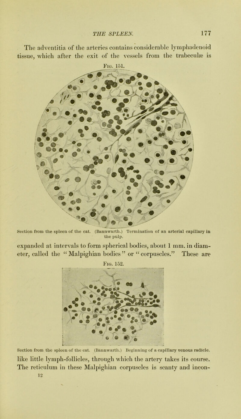 The adventitia of the arteries contains considerable lyinphadenoid tissue, which after the exit of the vessels from the trabeculse is Fig. 151. Section from the spleen of the cat. (Bannwarth.) Termination of an arterial capillary in the pulp. expanded at intervals to form spherical bodies, about 1 mm. in diam- eter, called the “Malpighian bodies’’ or “corpuscles.” These are Fig. 152. ( • • • \9 Section from the spleen of the cat. (Bannwarth.) Beginning of a capillary venous radicle. like little lymph-follicles, through which the artery takes its course. The reticulum in these Malpighian corpuscles is scanty and incon-