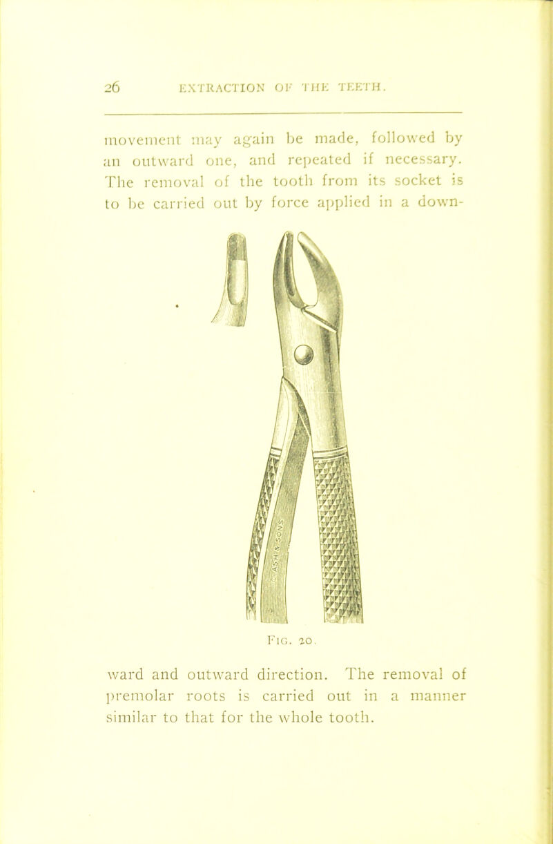 movement may again be made, followed by an outward one, and repeated if necessary. The removal of the tooth from its socket is to be carried out by force applied in a down- FlG. 20. ward and outward direction. The removal of premolar roots is carried out in a manner similar to that for the whole tooth.